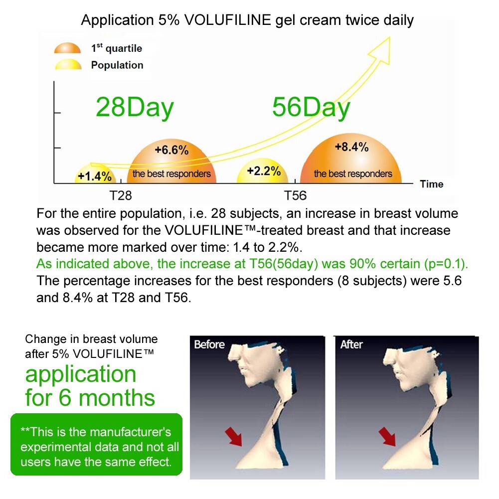 [Authenticity Check] – 100% Volufiline 10ml(0.34 fl. oz) France SEDERMA