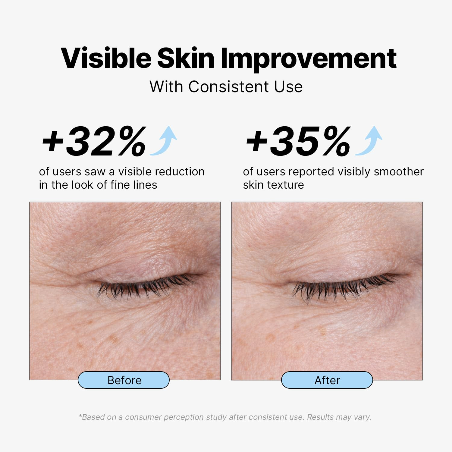 Retinol anti Aging Face Moisturizer: Wrinkle Cream for Women & Men, Collagen & 7