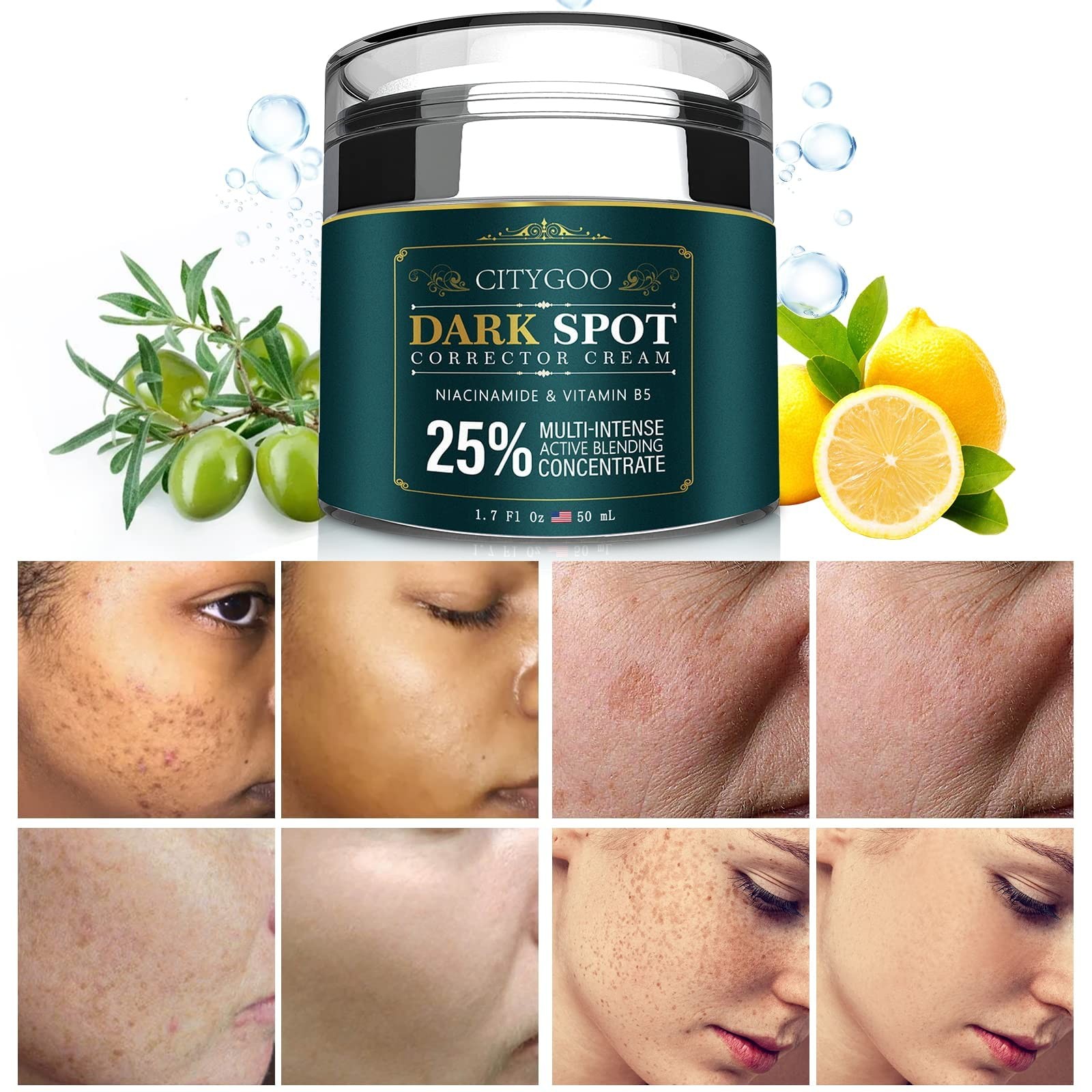 CITYGOO Dark Spot Remover for Face: Dark Spot Corrector Cream – Enriching Skin