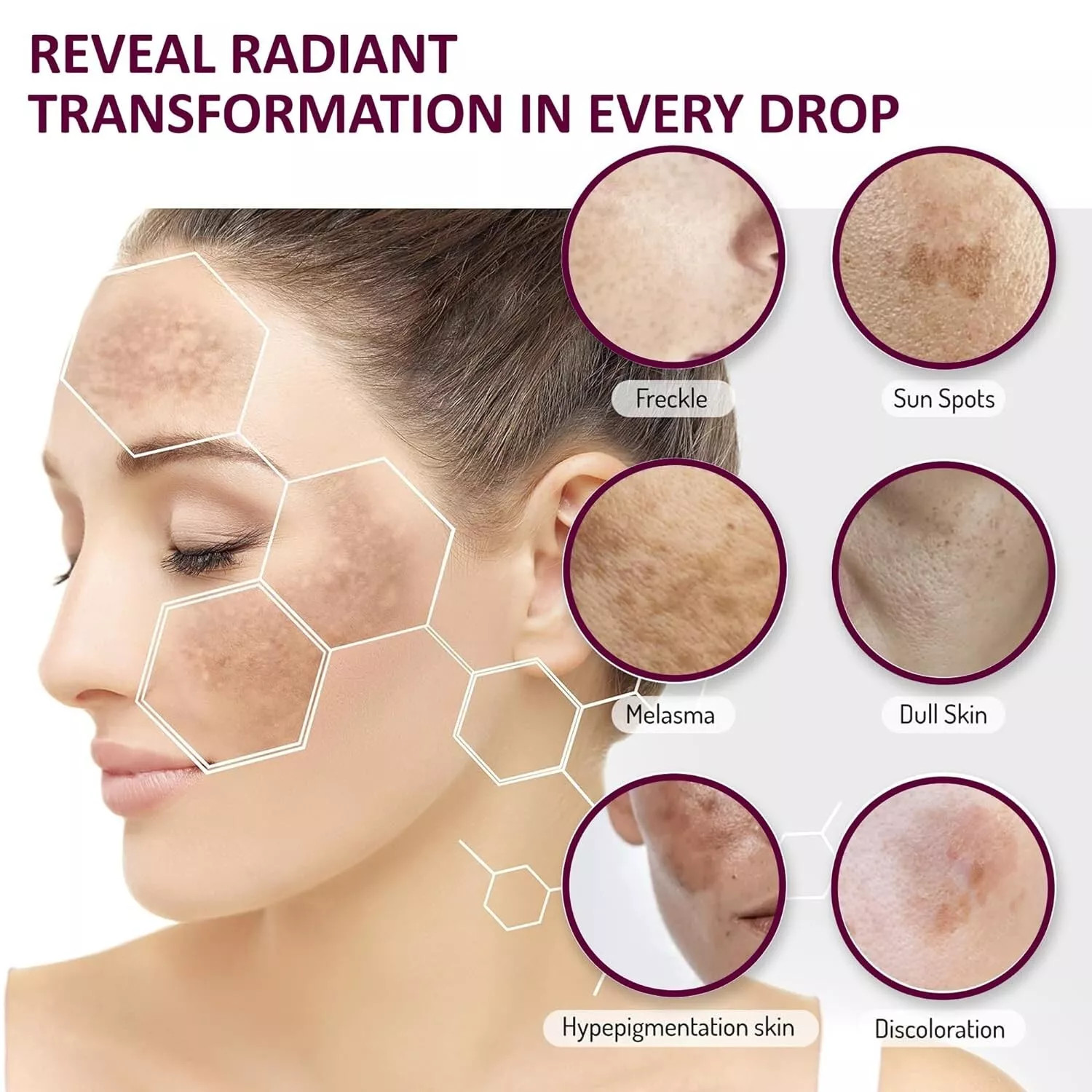 7 Days Pigmentation & Dark Spots Removal Face Serum 30 ml