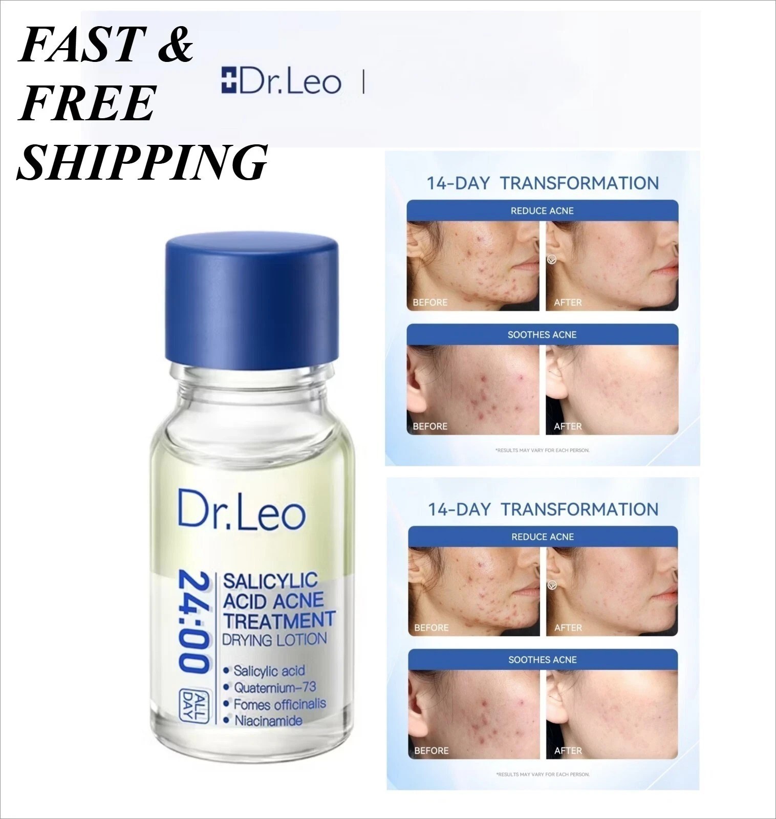Dr. Leo Acne Essence – Salicylic Acid Serum for Acne & Scars NEW