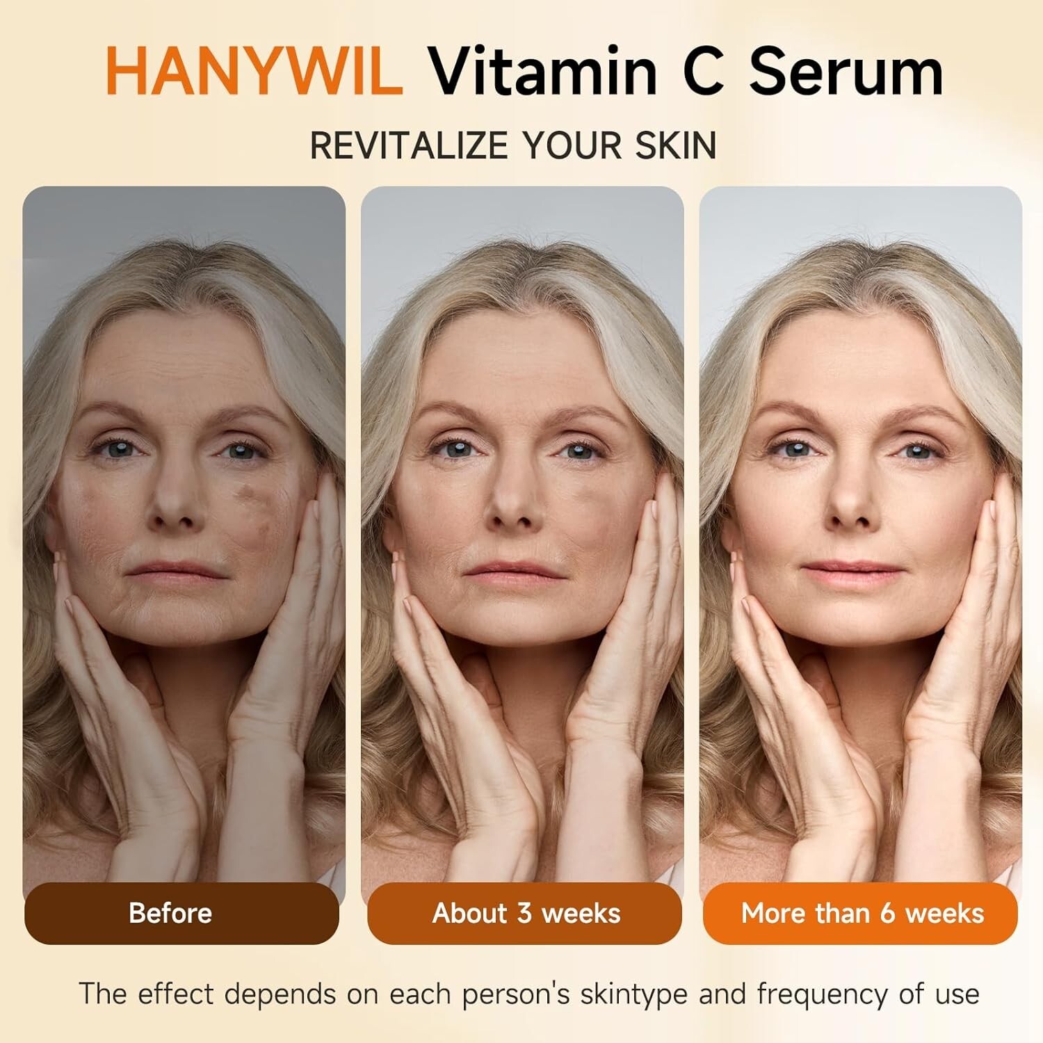 Vitamin C Serum for Face, Dark Spot Remover,Hydrates and Wrinkle Reduction-1.7oz