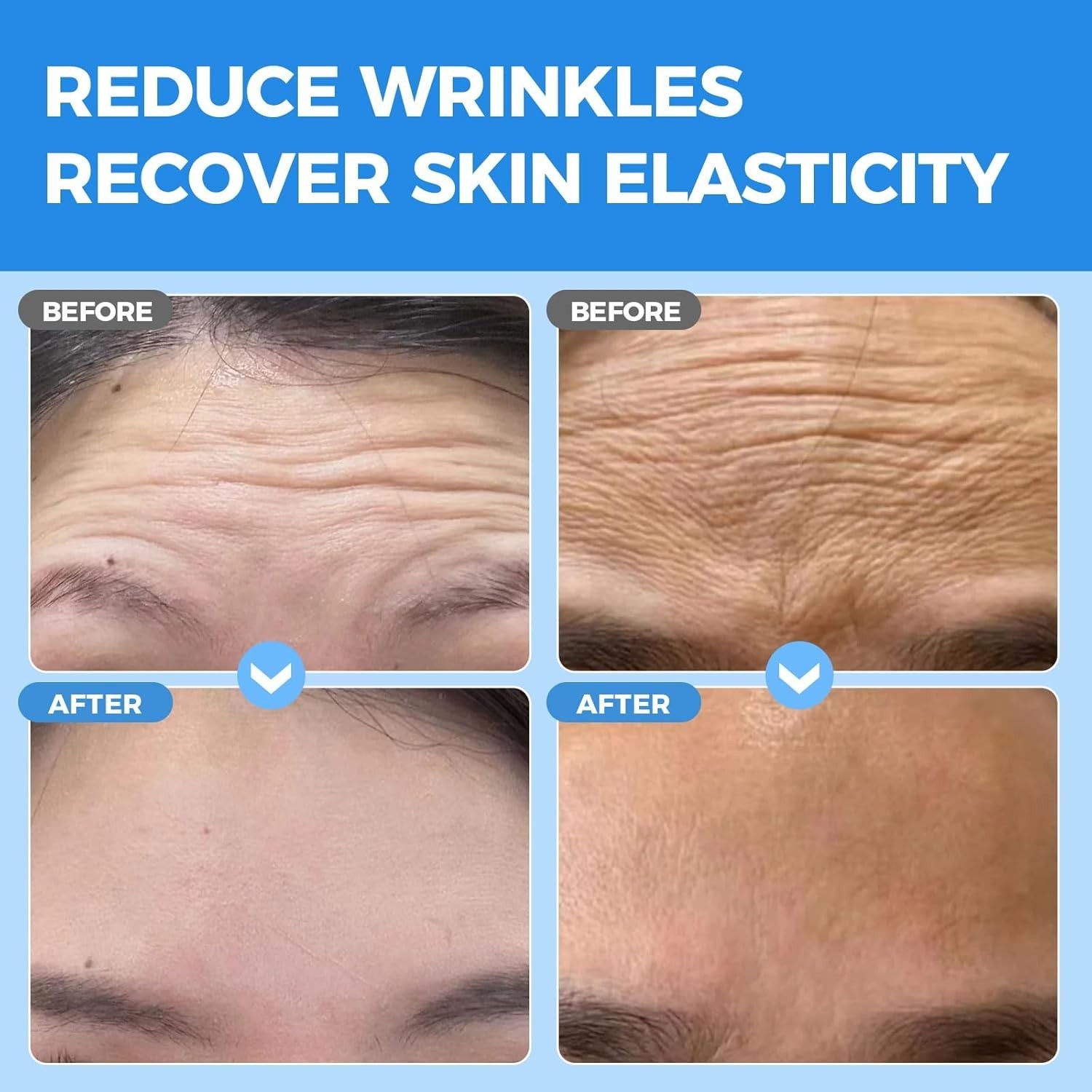 Overnight Forehead Wrinkle Patches – Collagen Infused for Smoother Skin 20 pcs