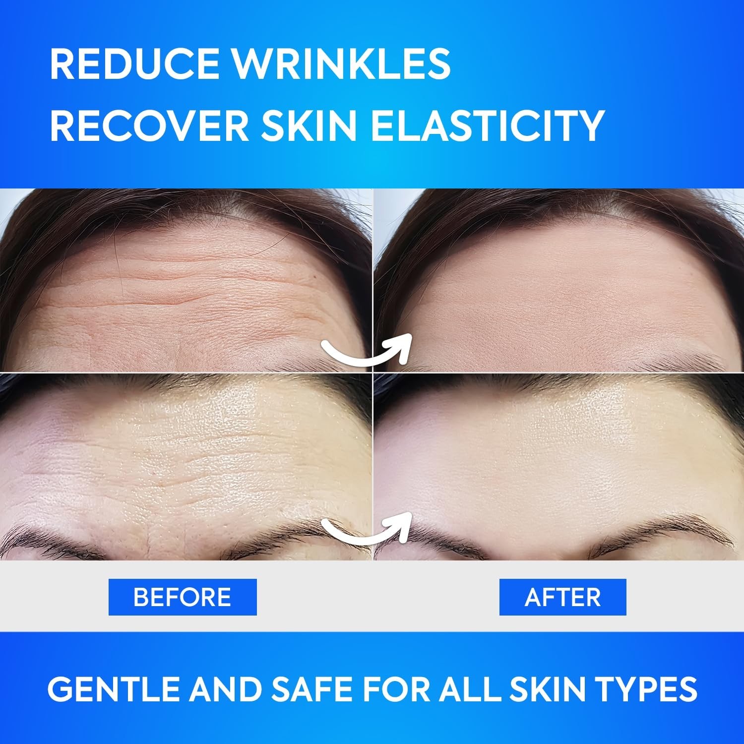 Forehead Wrinkle Patches 12Pcs with Aloe, Collagen, Vitamin E, Anti Wrinkle P…