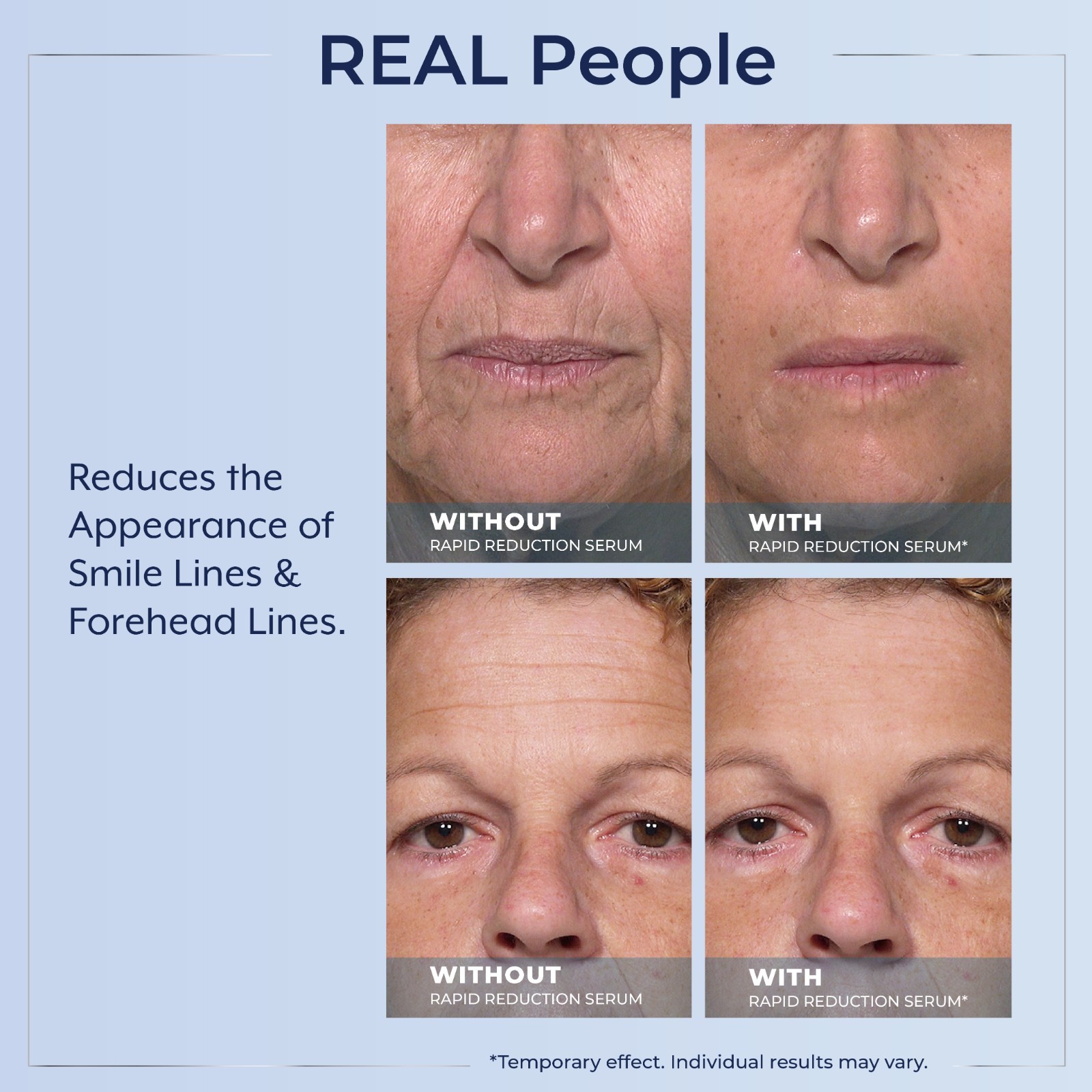 Plexaderm Rapid Reduction Serum