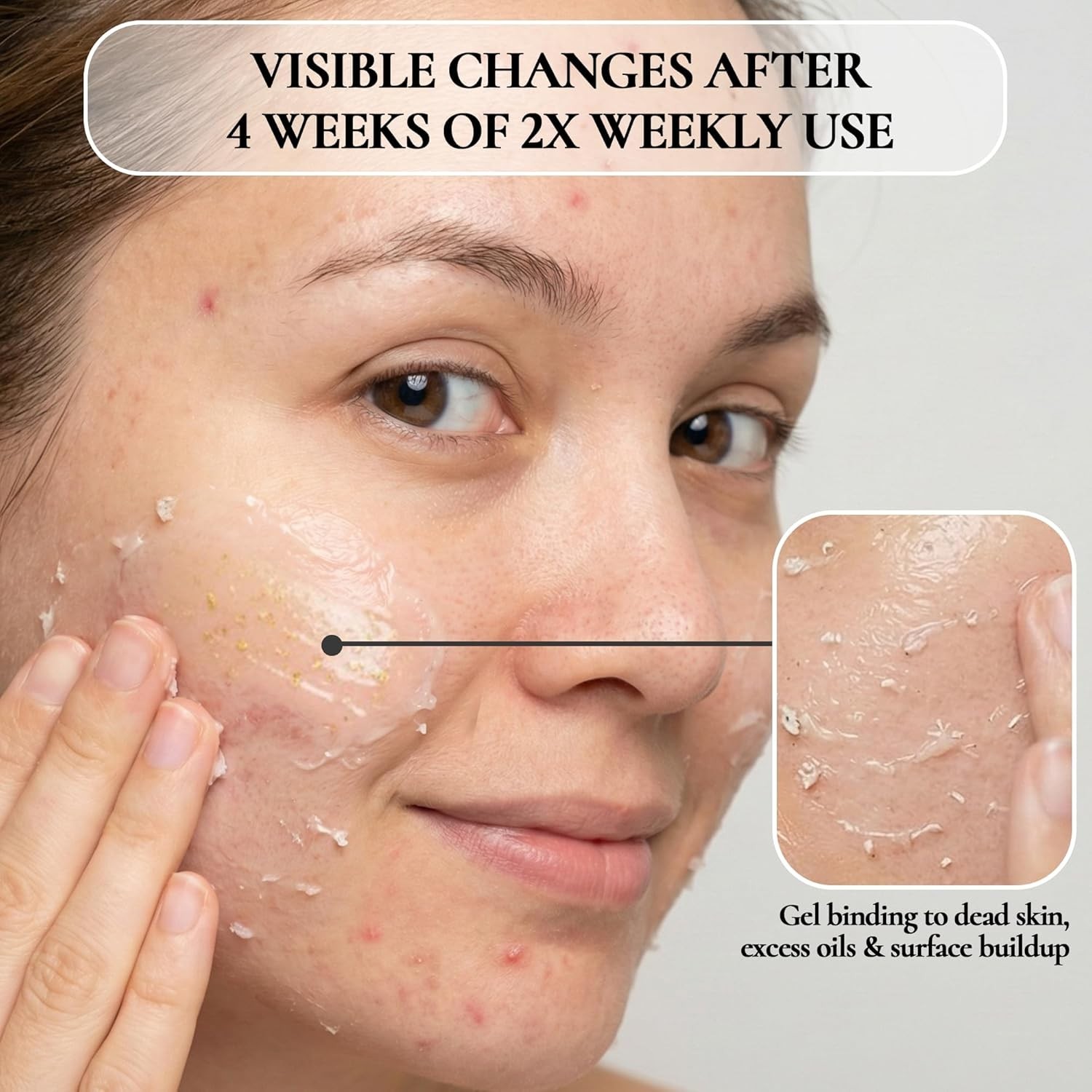 Visible Results Facial Peeling Gel – 4.05 Fl Oz For Smoother, Brighter Skin