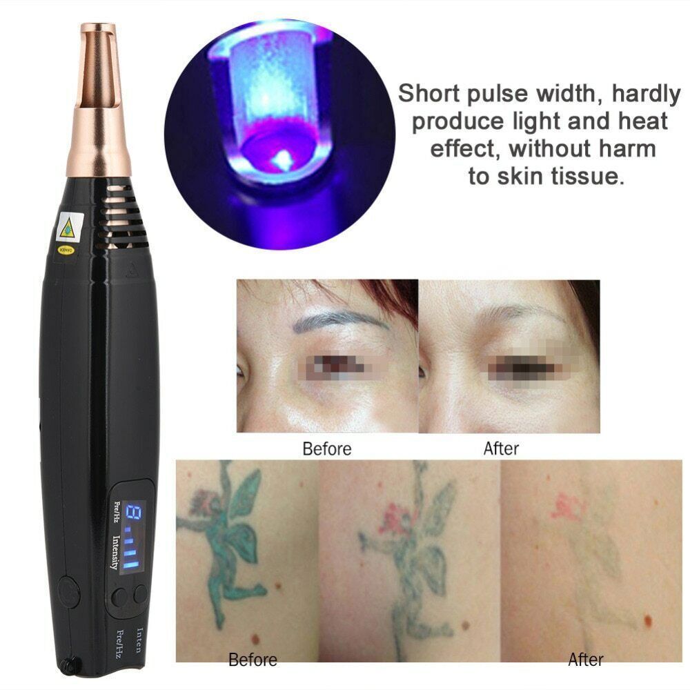 Handheld Picosecond Laser Pen Scar Freckle Tattoo Removal Machine Beauty Skin US