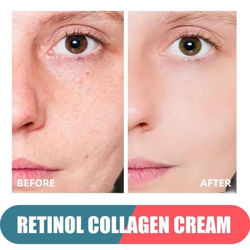 Retinol Moisturizer with Hyaluronic Acid Day Night Anti Aging Face Cream