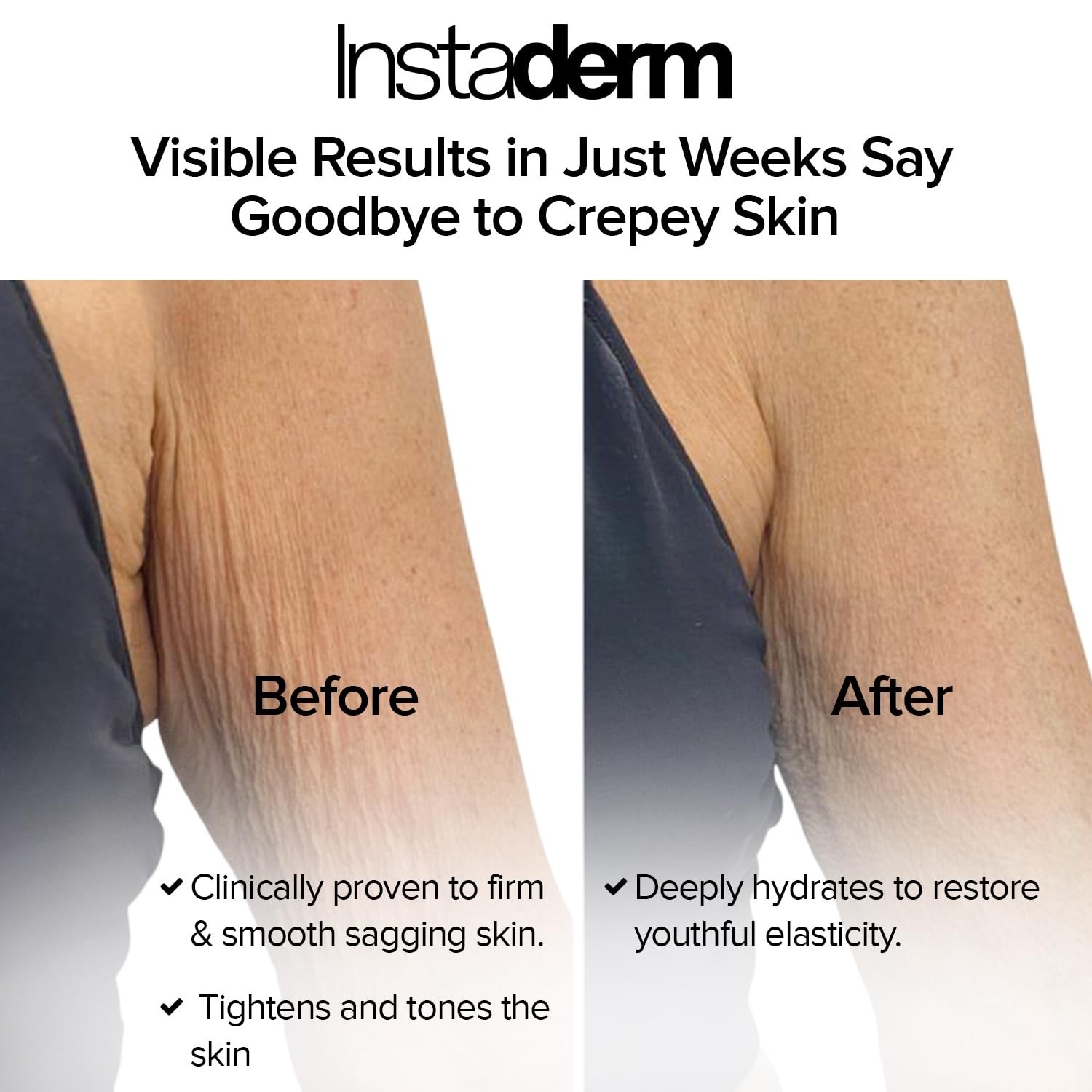 Instaderm Creep Fix Body Restorative Cream Anti-Aging Wrinkle Cream 8 Oz. Jar NE