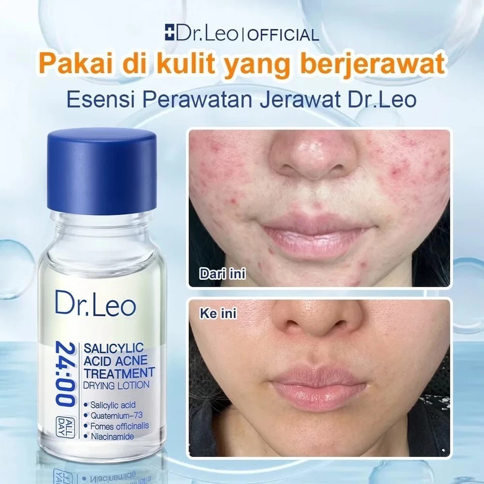 NEW Dr. Leo Acne Essence – Salicylic Acid Serum for Acne & Scars