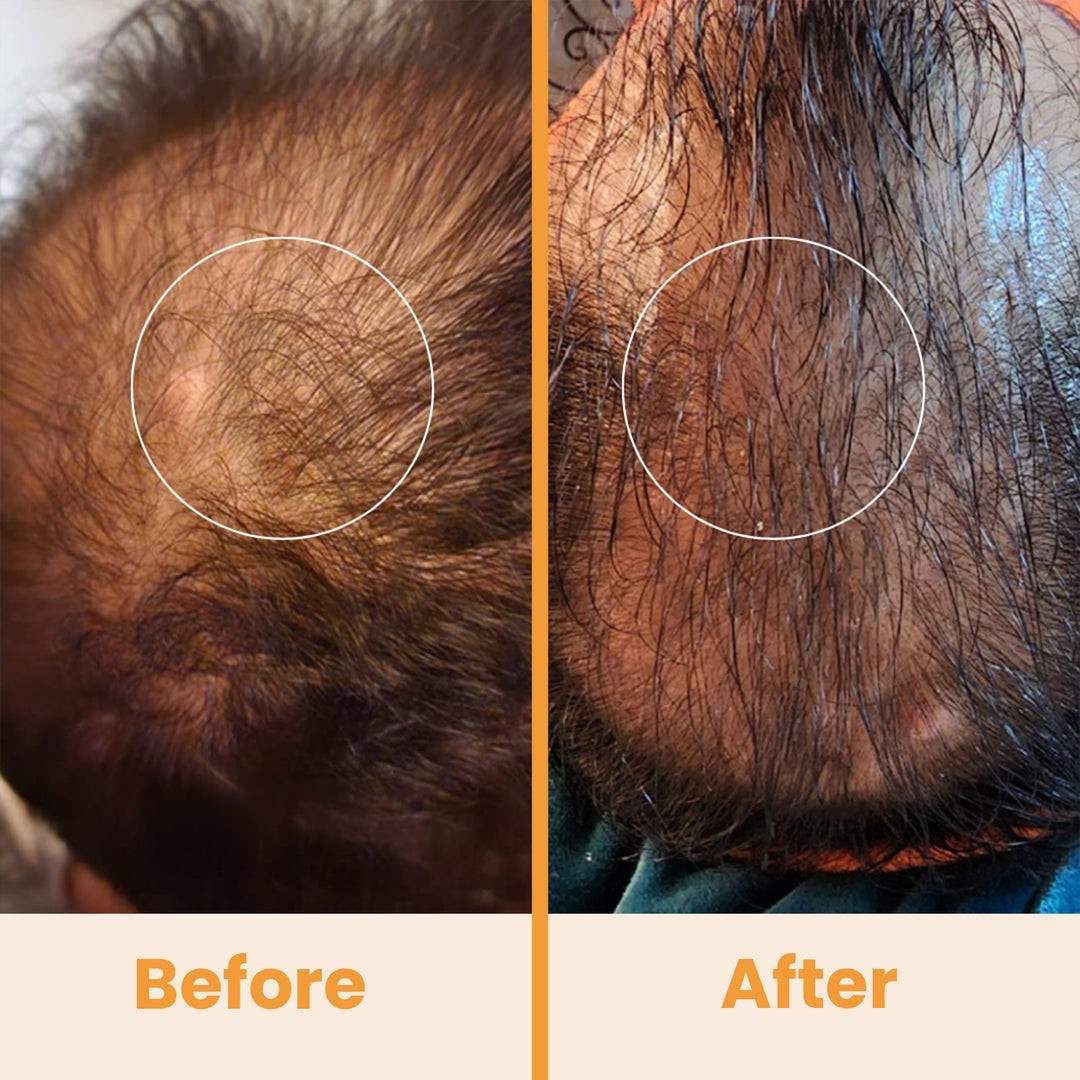 NuDerma Standard High Frequency System. Pure Daily Care