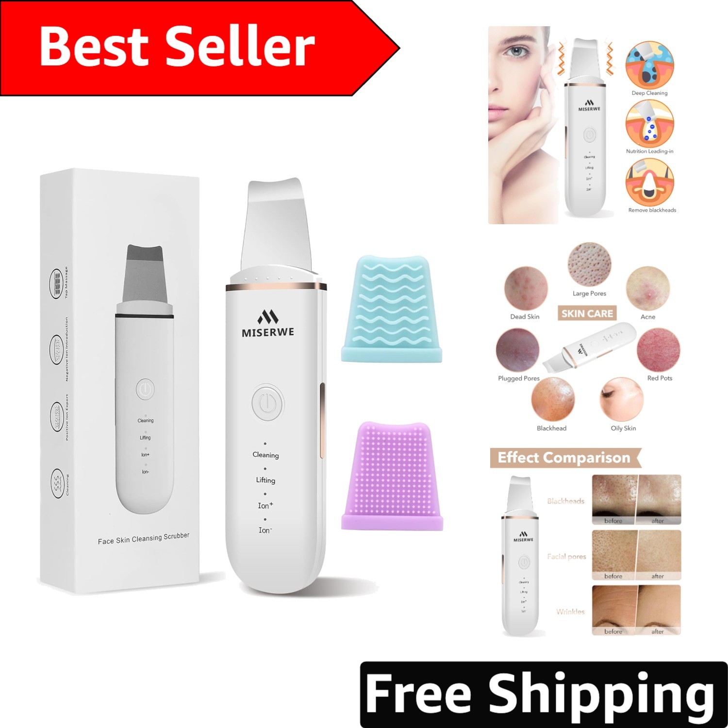 4 Modes Skin Spatula: The Ultimate Blackhead Remover for Flawless Skin