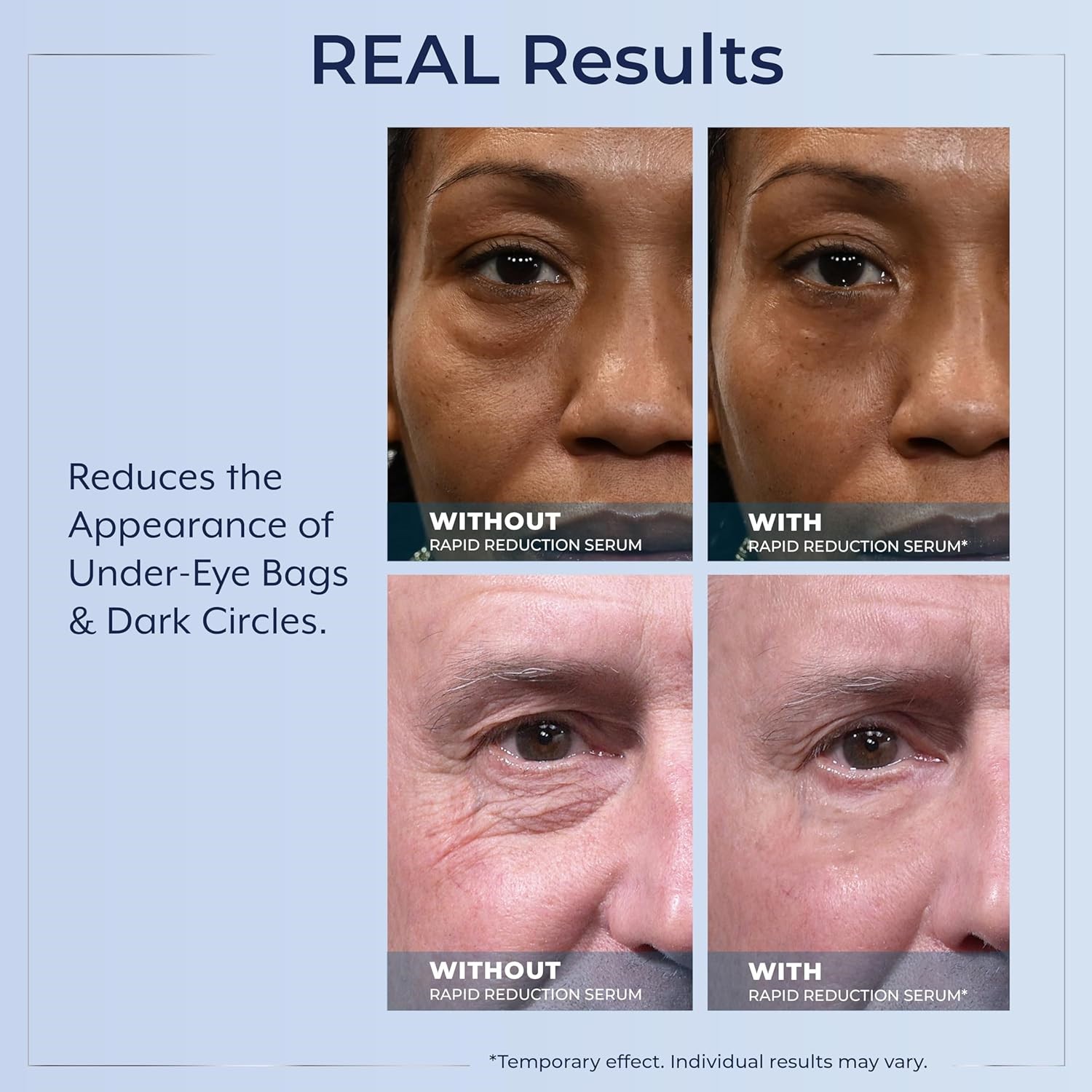 🔥Plexaderm Rapid Reduction Serum 0.33oz Visibly Reduces Under-Eye Bags,Wrinkles