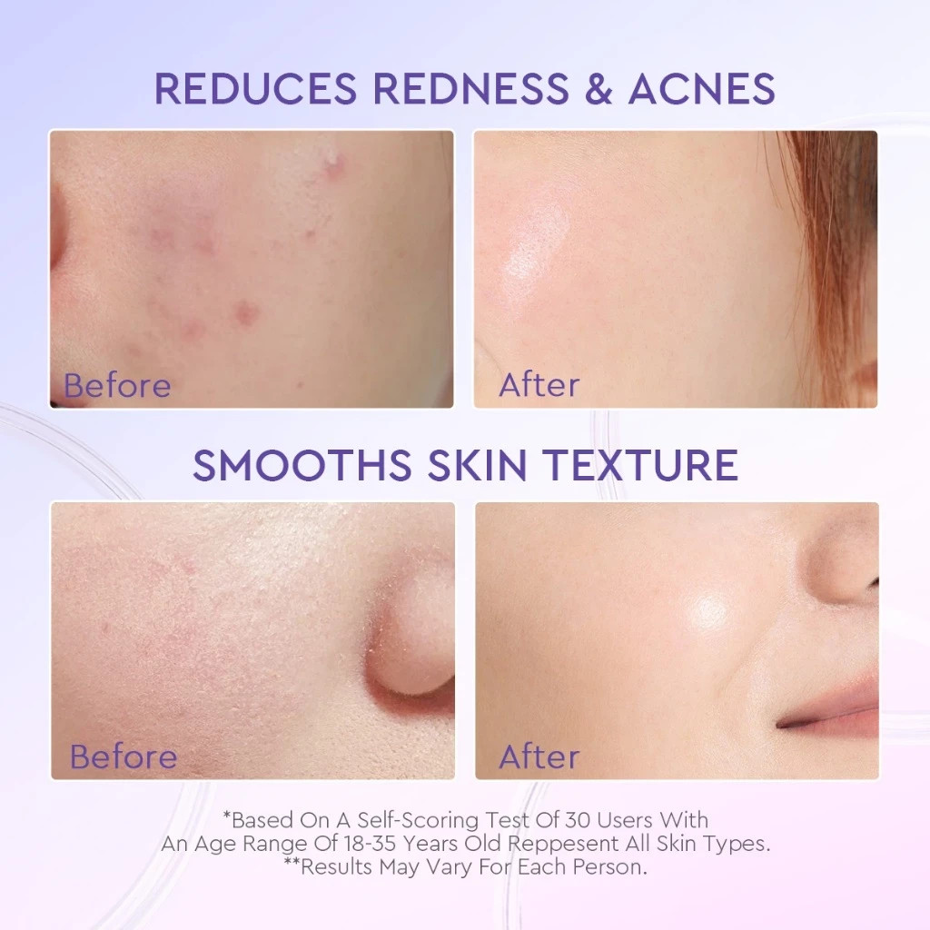 Glad2glow 2IN1 Aha Bha Pha Intensive Peeling Solution Serum Essence Glowing Skin