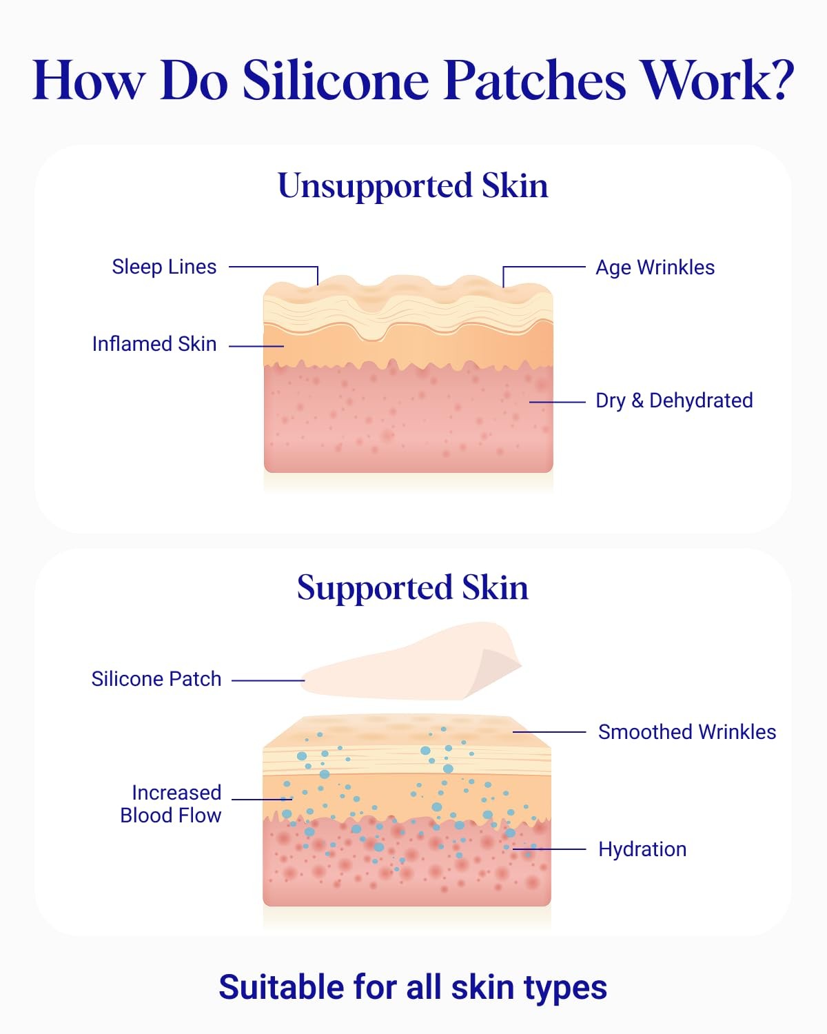 Neck Wrinkle Patch – Reusable Silicone Smoothing Pads, Sensitively Formulated…