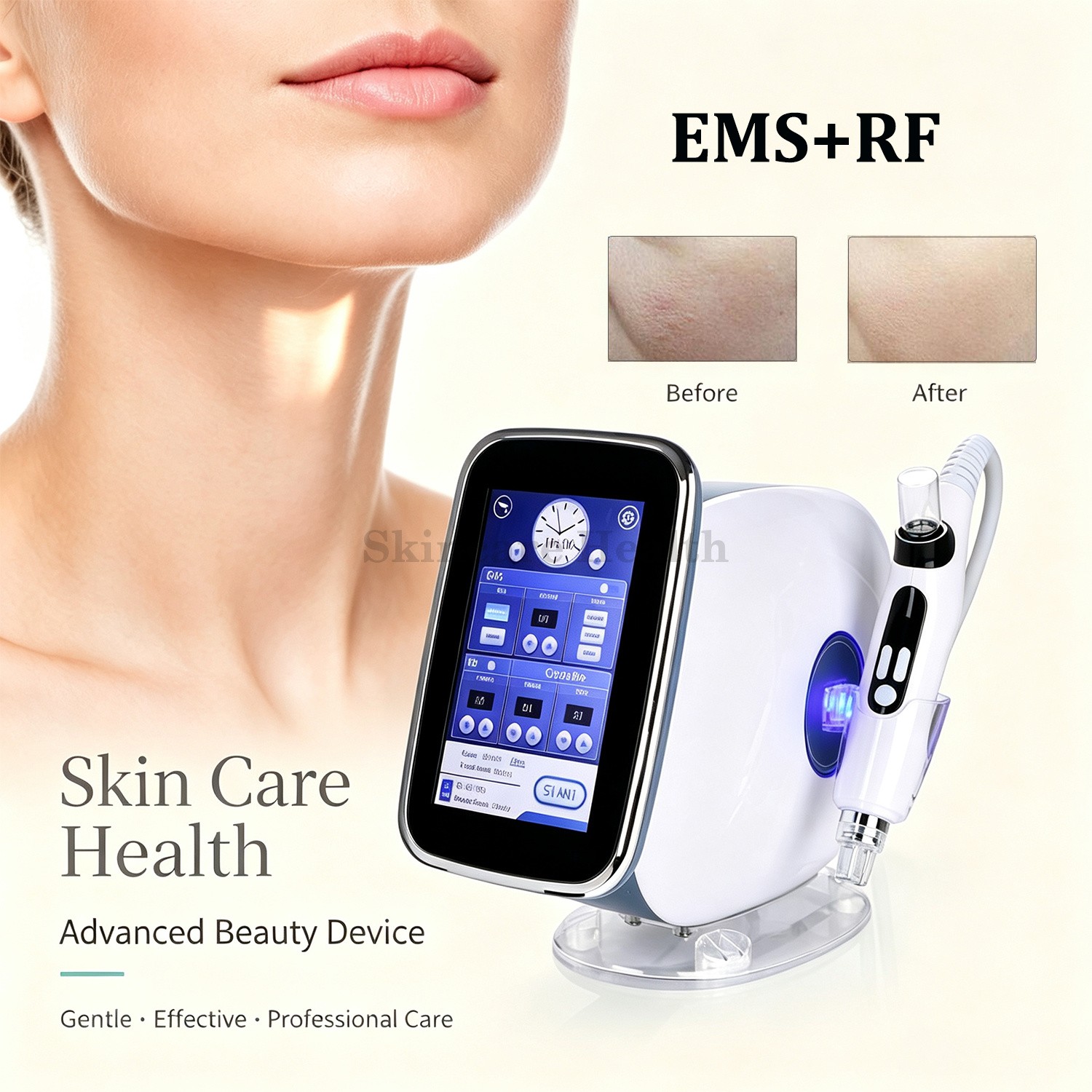 EMS Meso Injector No Needle Skin Wrinkle Removal Care Machine RF Mesotherapy Gun
