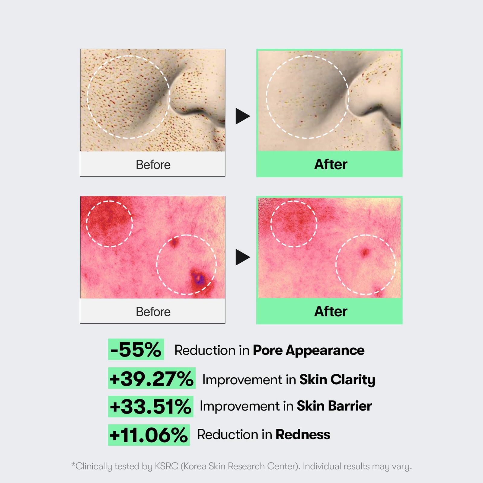 CICA Reedle Shot 100, Spicule Microneedling Serum for Pore Care & Exfoliation…
