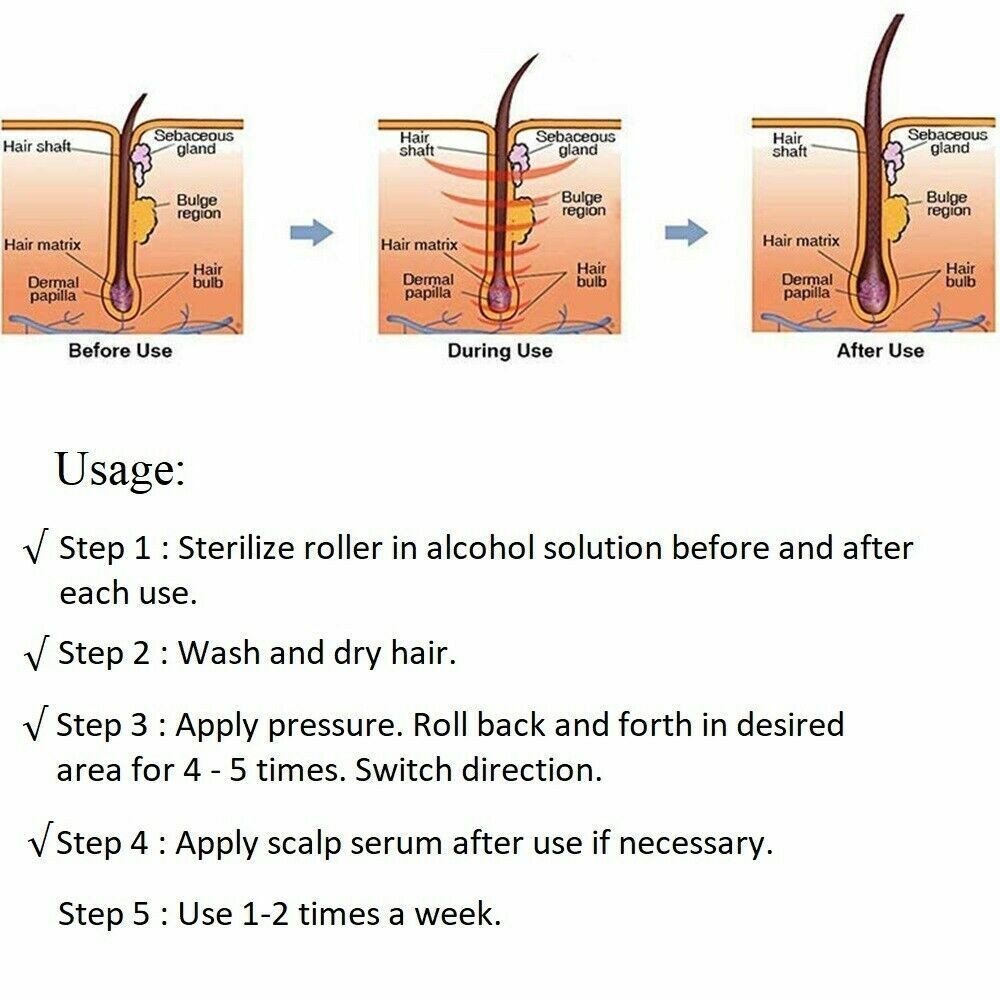 1.0mm Derma Roller Hair Regrowth Micro Needle Roller Beard Growth Anti Hair Loss