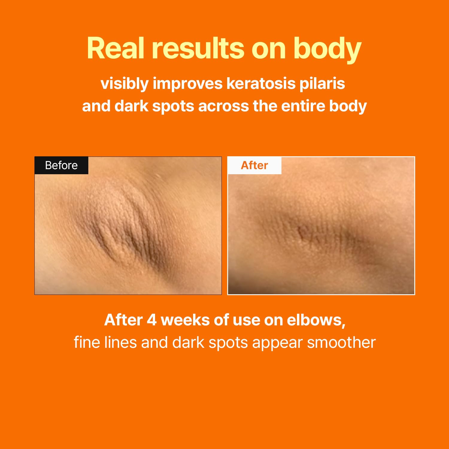 Retinal Skin Booster Serum – Beginner Friendly Non-Irritating Retinaldehyde for