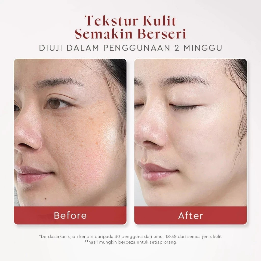 Glad2glow 2IN1 Aha Bha Pha Intensive Peeling Solution Serum Essence Glowing Skin