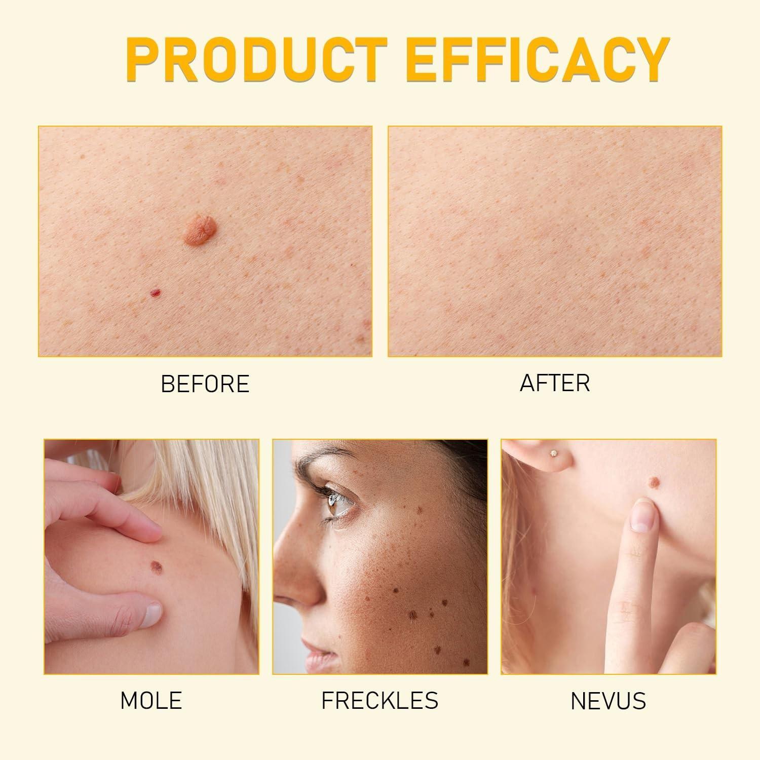 Bee Venom Skin Restoration Cream, Professional Bee Venom Skin Cream,deeply …..