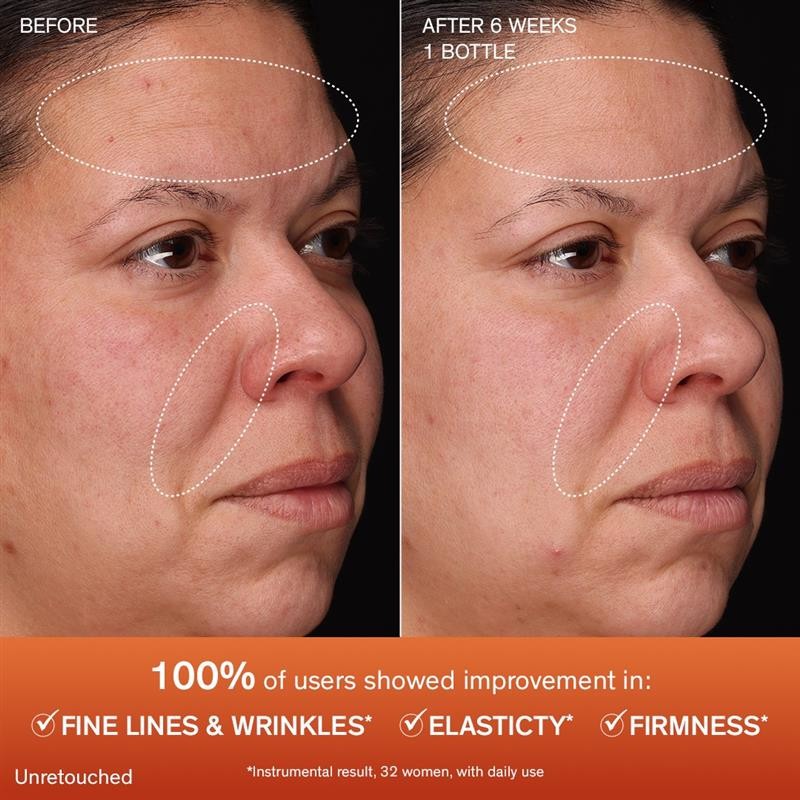 Sulwhasoo Concentrated Ginseng Rejuvenating Serum 1ml x 70pcs (70ml) Anti-aging