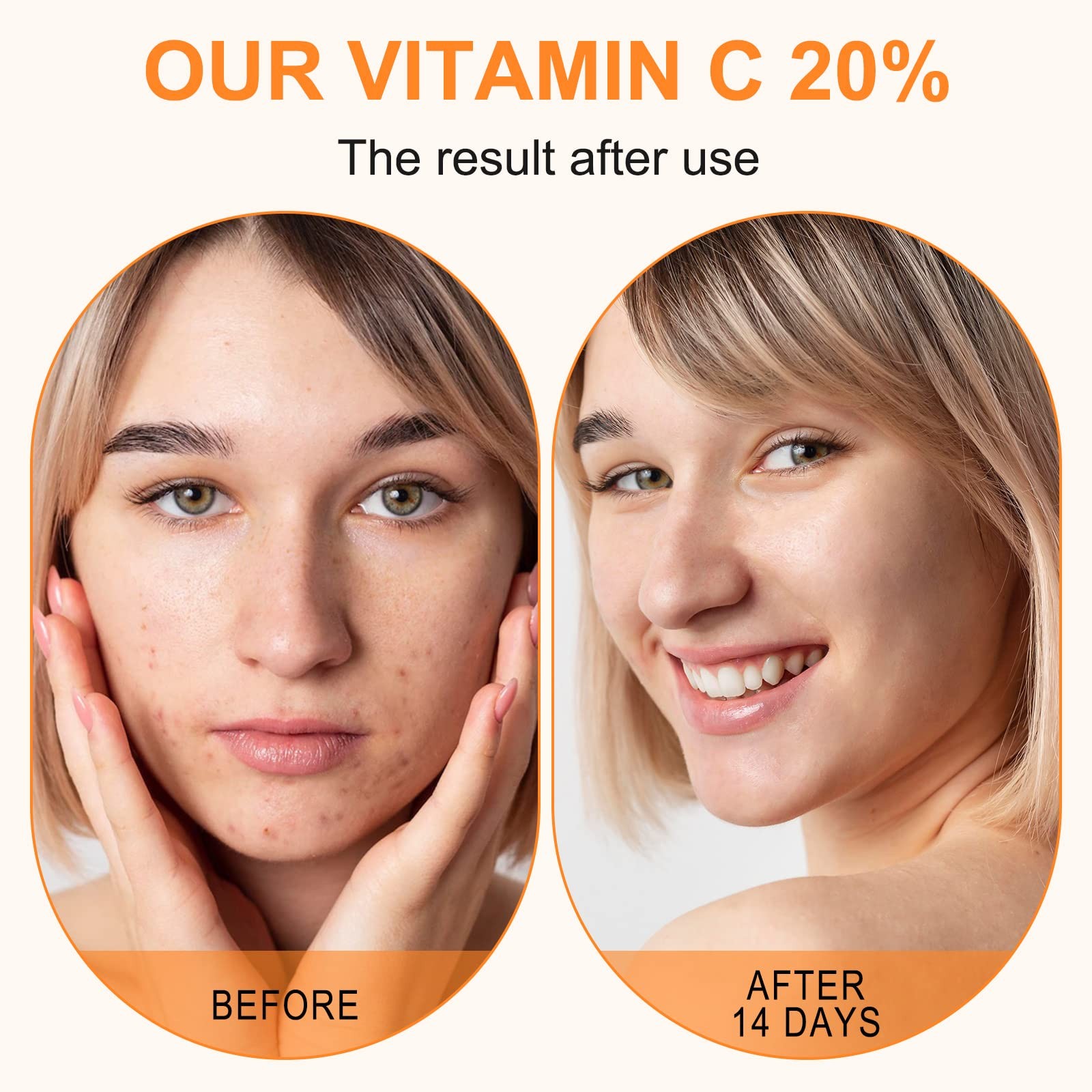 Premium 20% Vitamin C Serum For Face with Hyaluronic Acid, Retinol & Amino Ac…