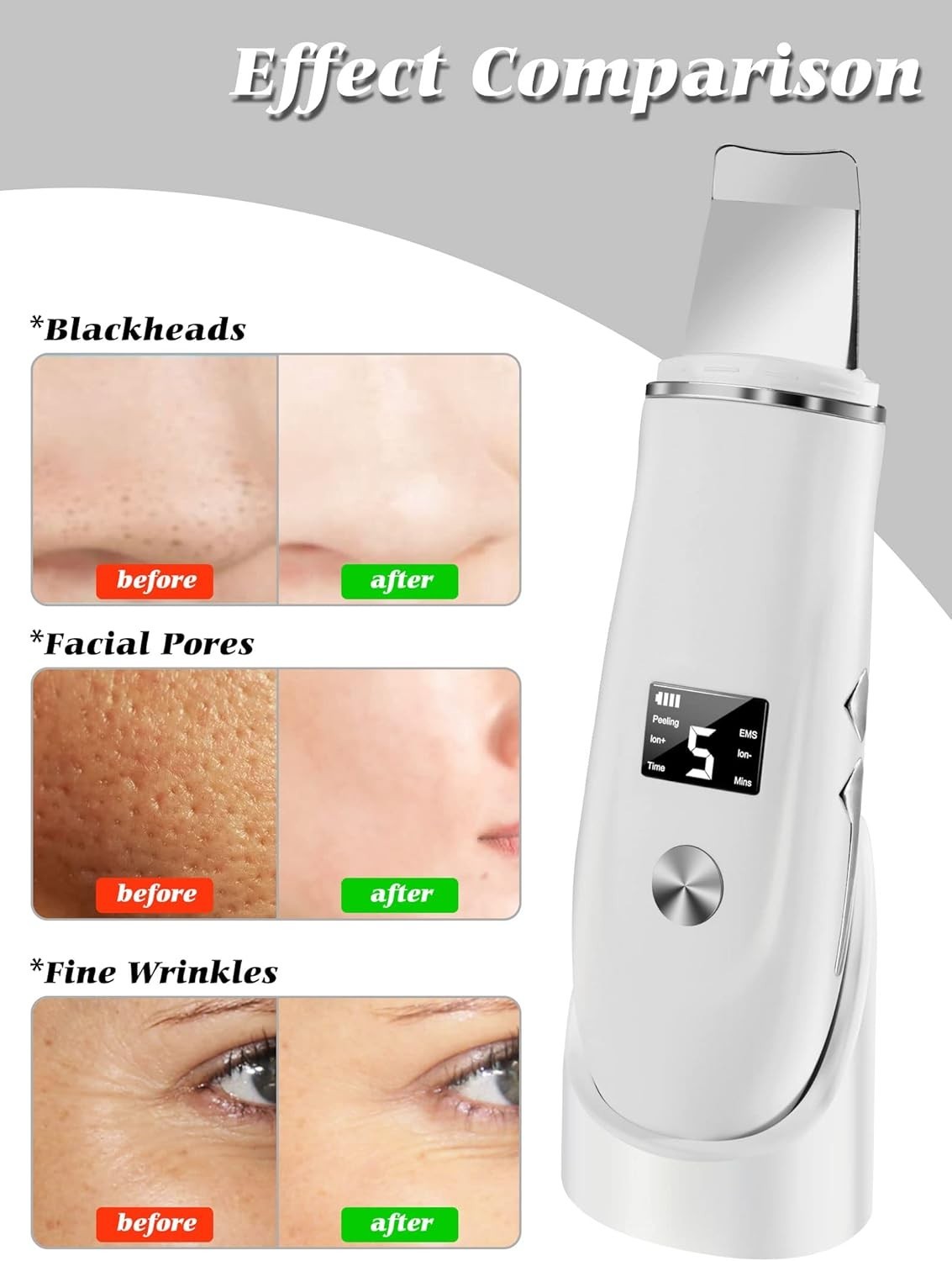 Gentle 4-in-1 Facial Skin Scrubber for All Skin Types – Spa Quality in Home