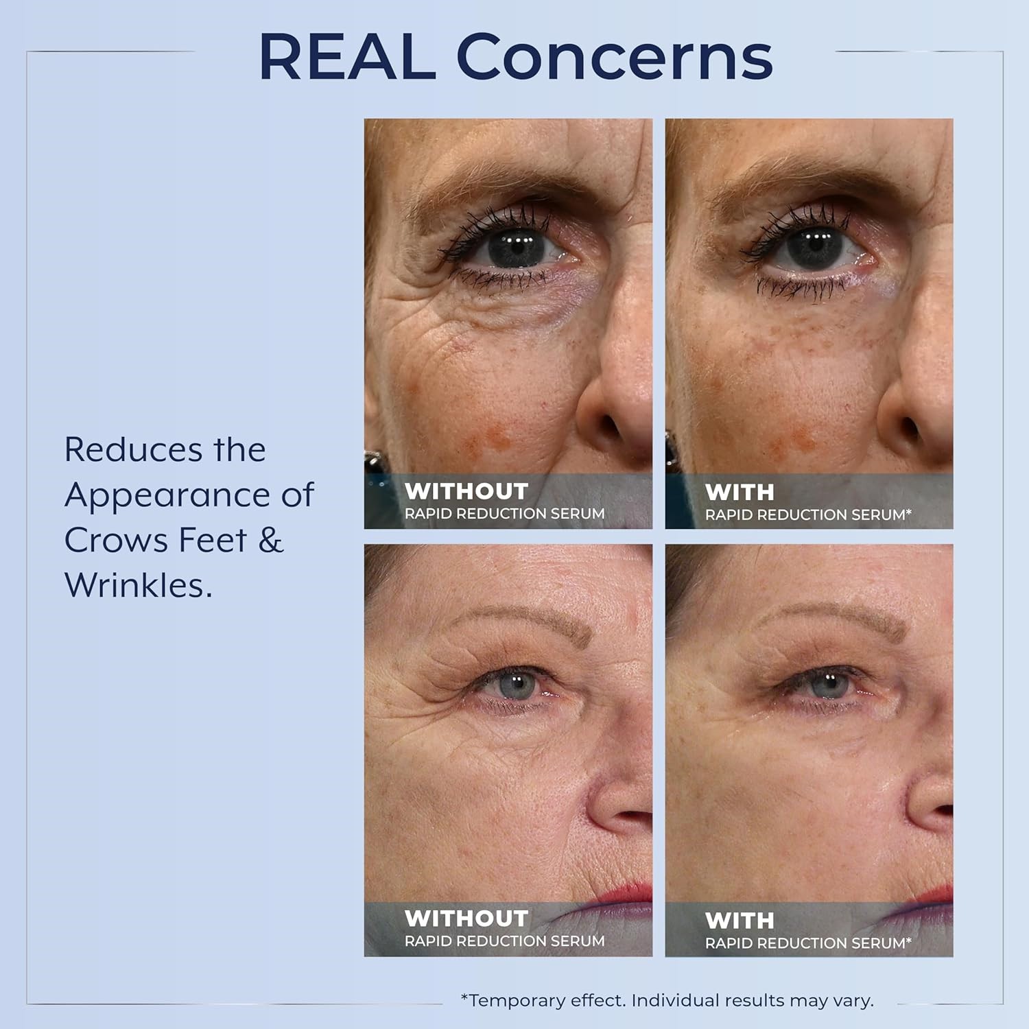 🔥Plexaderm Rapid Reduction Serum 0.33oz Visibly Reduces Under-Eye Bags,Wrinkles