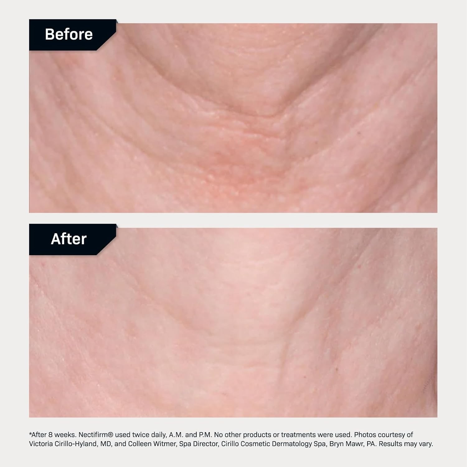 Nectifirm Advanced Neck Cream – Clinically Proven to Firm, Lift & Contour the…