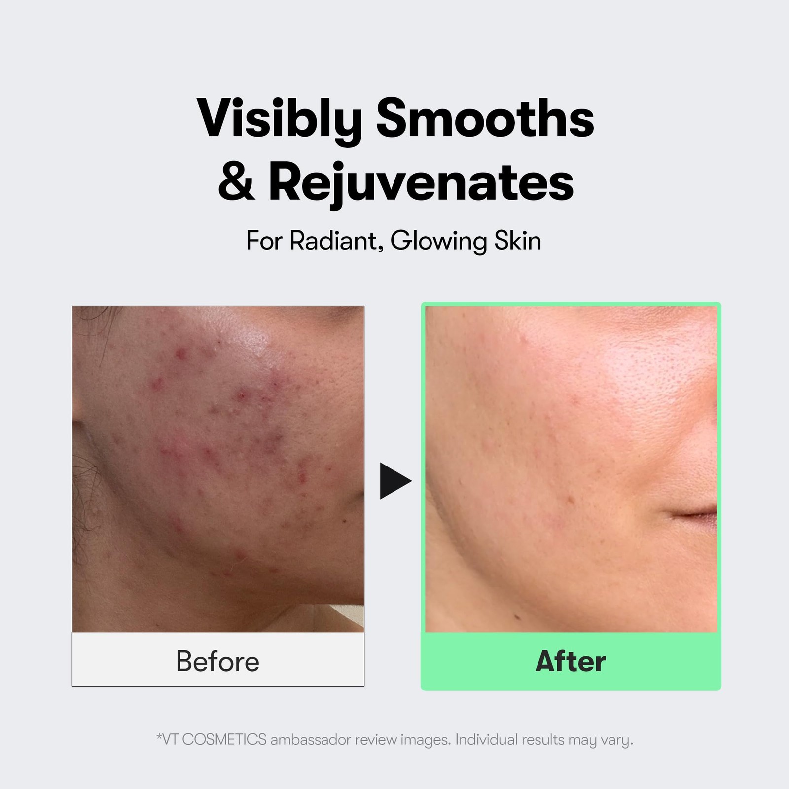 CICA Reedle Shot 100, Spicule Microneedling Serum for Pore Care & Exfoliation…