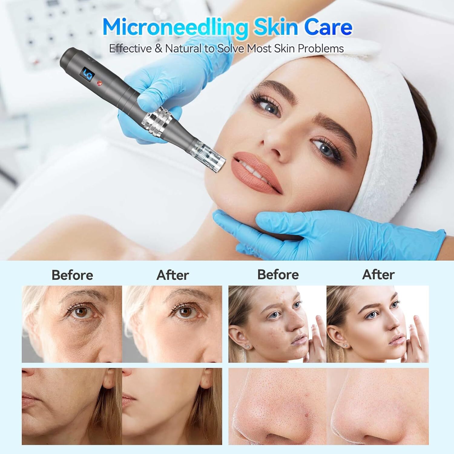 Professional Wireless Electric Microneedling – Pen with 10pcs Cartridges Kit