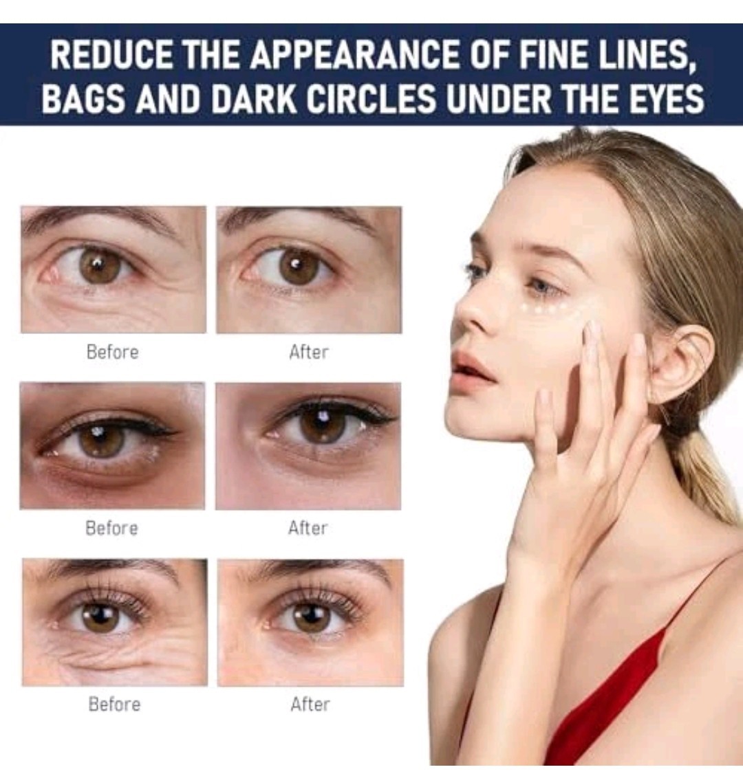 2Pcs Rapid Reduction Eye Serum – Advanced Formula Anti Wrinkle- Instantly Elimin