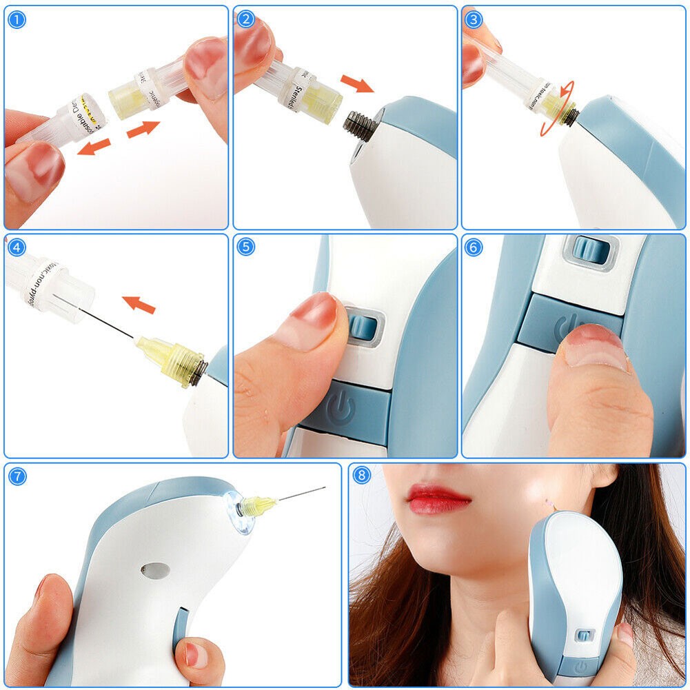 New Plasma pen with cartridge eyelid lift fibroblast tightening skin resurfacing