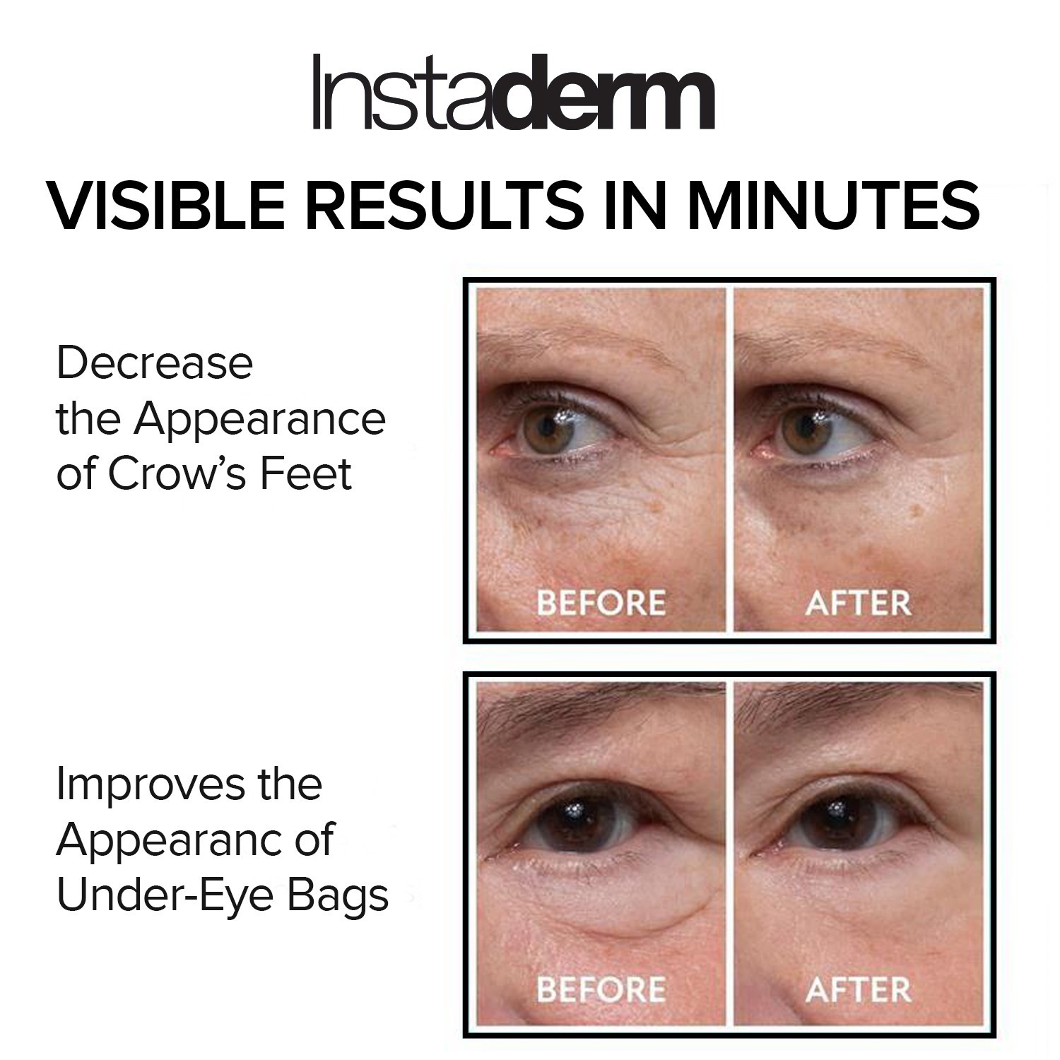 Instant Puffy Eye & Lift Treatment – Removes Under Eye Bags & Puffiness.