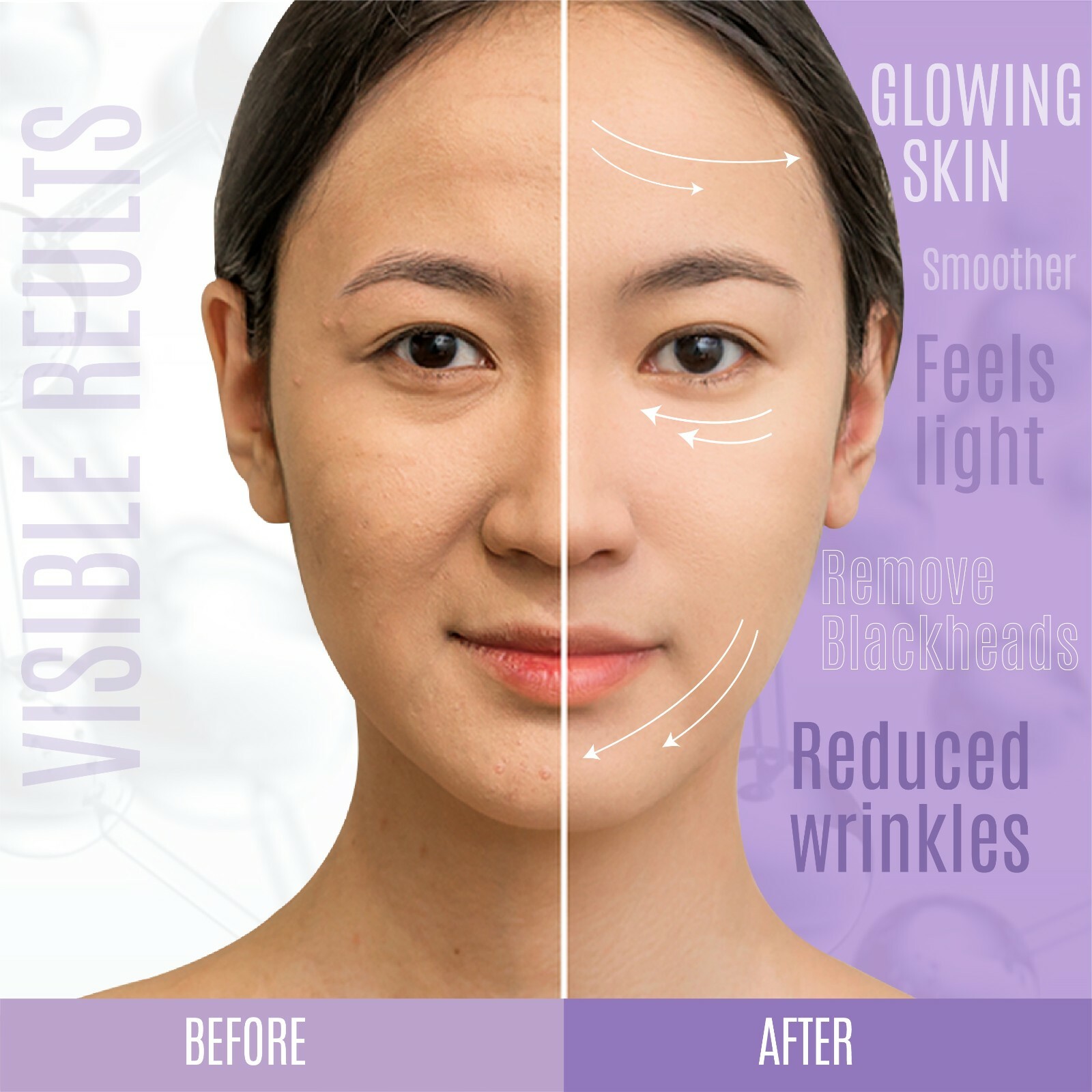 Botox Wrinkle Remover Matrixyl 3000, Peptide Boost, Hyaluronic Acid, Face Serum