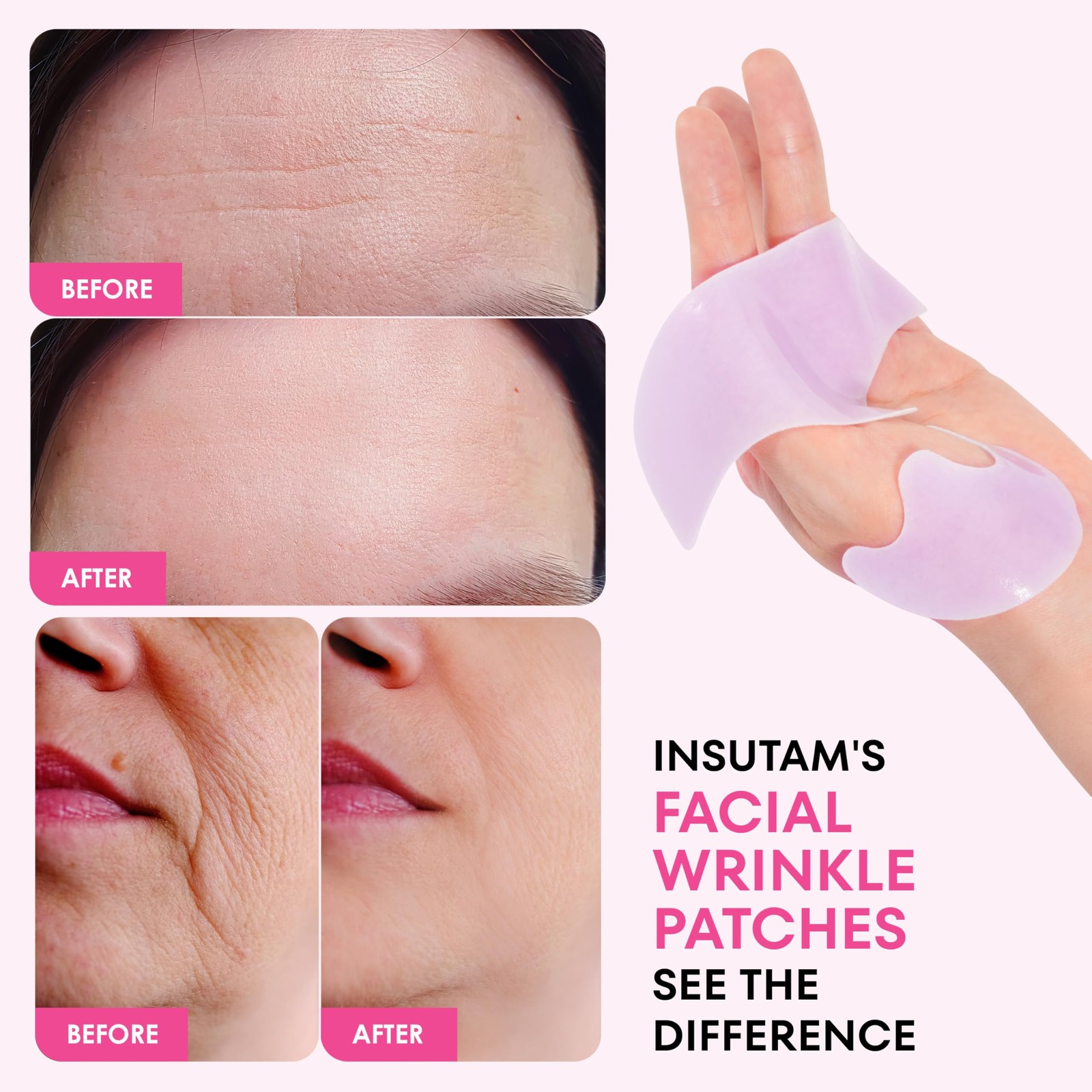 Forehead Wrinkle Patches for Anti-wrinkles: Overnight Face Wrinkles Patches t…