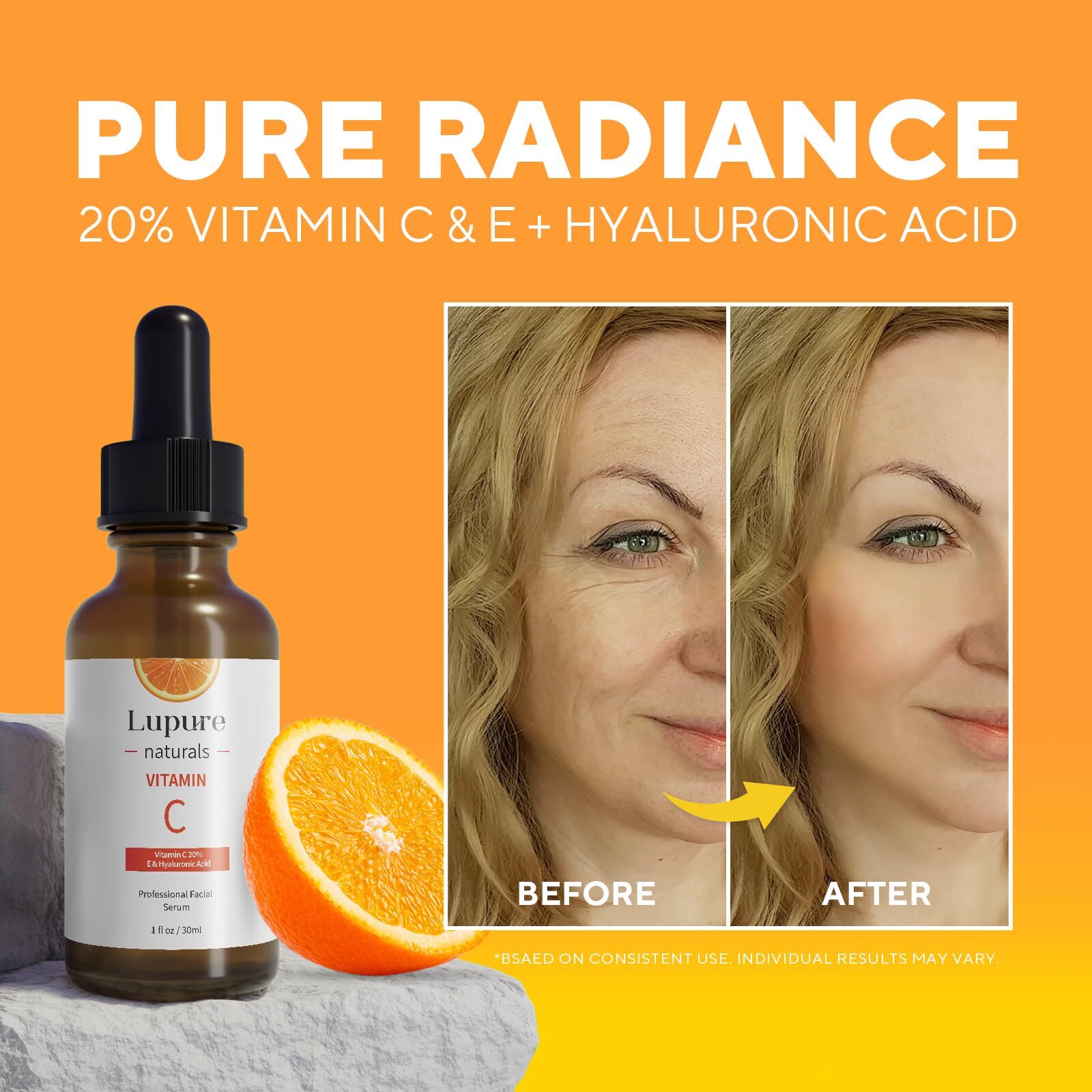 Lupure Professional Vitamin C Face Serum 20% Anti Aging Facial Super Vit C Se…