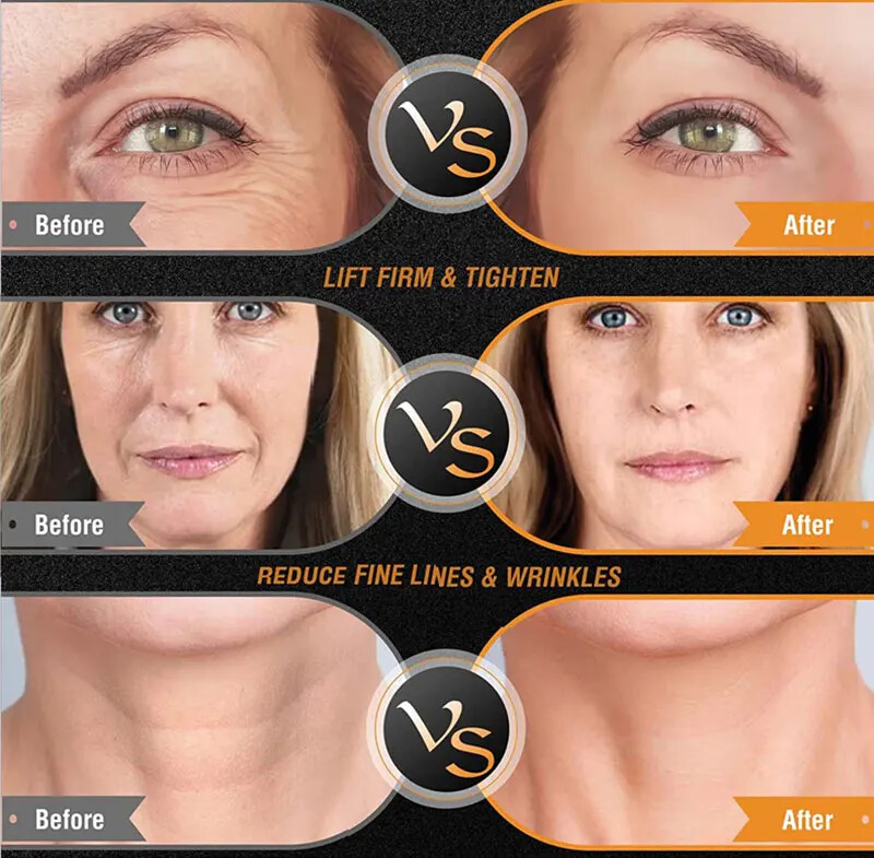 Facial Body Machine Skin Tightening Face Lifting RF Beauty Skin Care Anti Aging