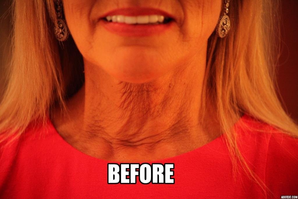 NeckTITE Magic – The Instant Neck Lift 12 Count (Pack of 1)