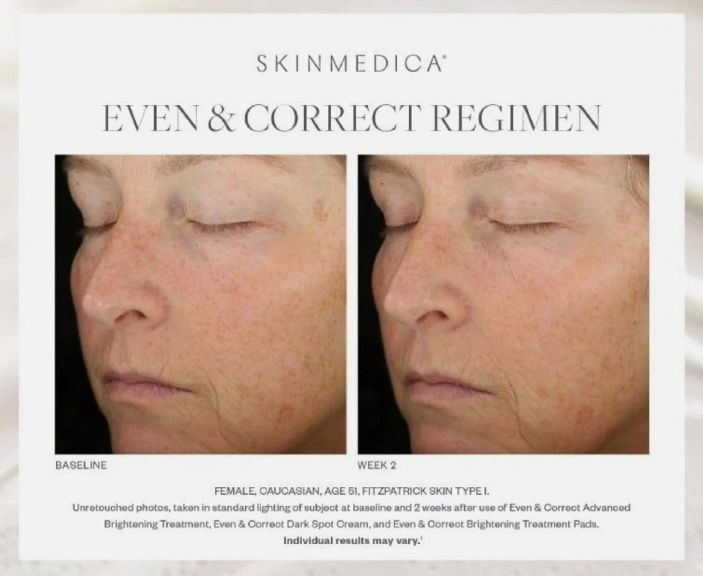 SkinMedica Even & Correct Brightening Treatment Pads, 60 Pads New
