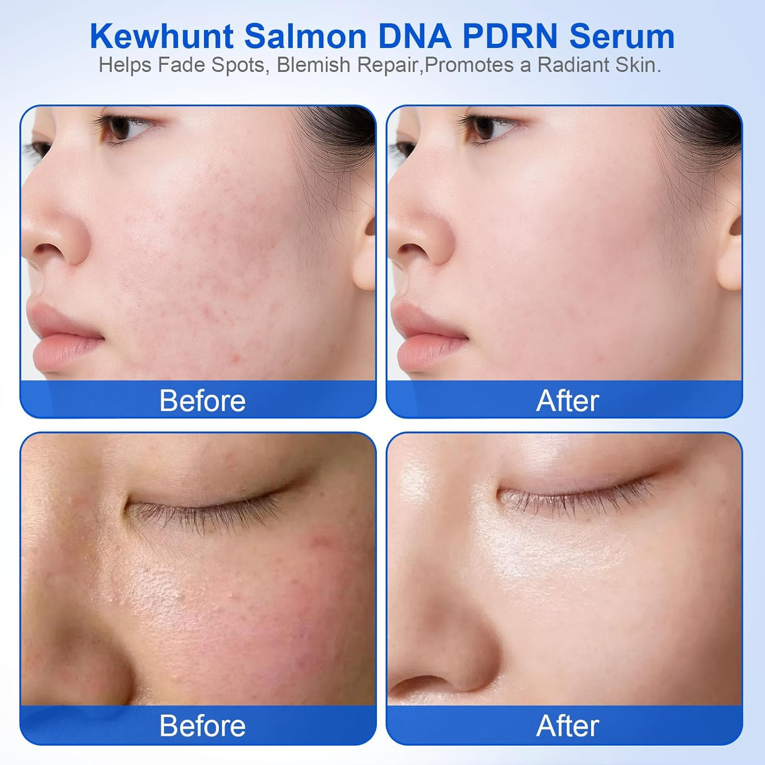 Salmon DNA PDRN Anti-Aging Facial Serum, 10,000Ppm Salmon Egg DNA Ampoule, 3000P