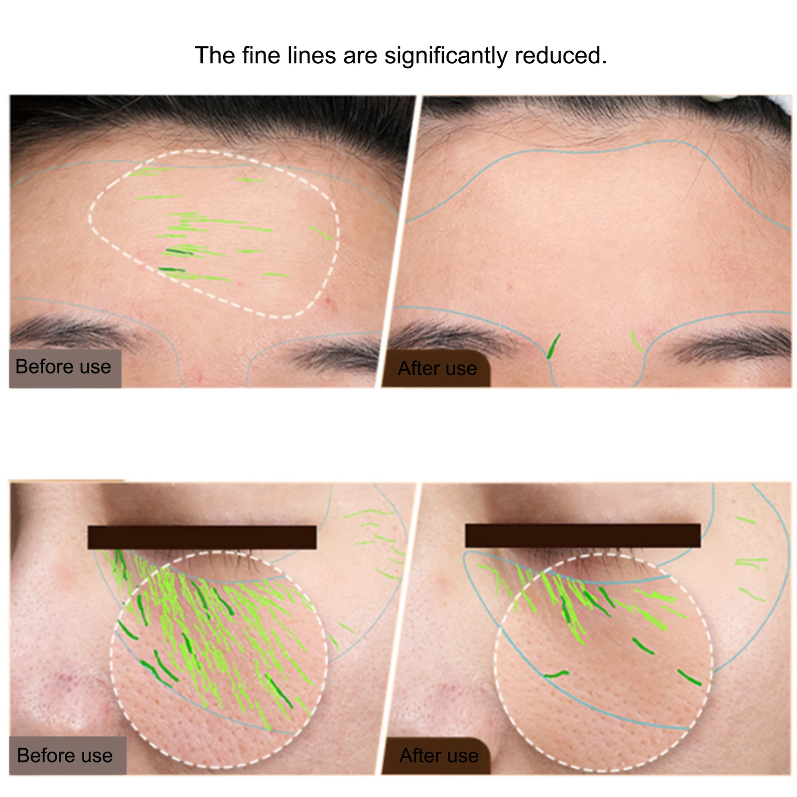 Facial Body Machine Skin Tightening Face Lifting RF Beauty Skin Care Anti Aging