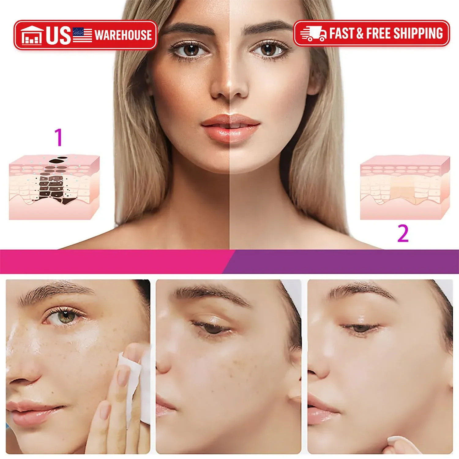 Dark Spot on the Face, Niacinamide 20G Crema para Manchas Oscuras en la Cara, Me