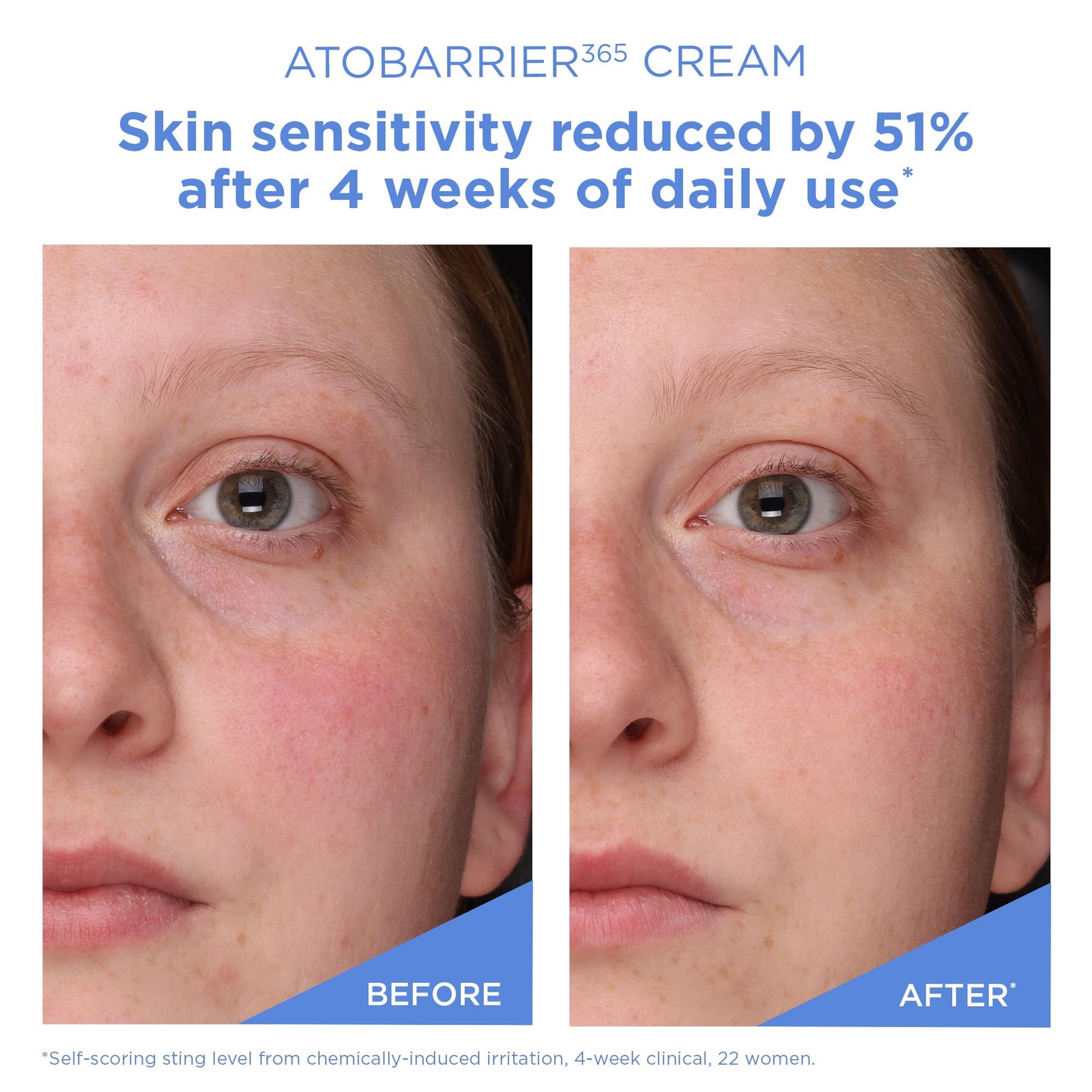 ATOBARRIER365 Cream with Ceramides, Korean Moisturizer for Barrier Repair | 1…