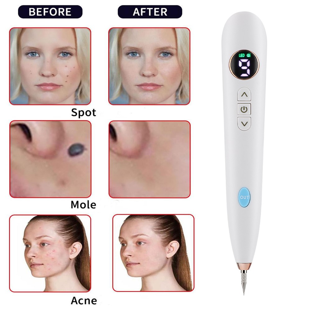 9 Level Laser Plasma Pen Mole Removal Dark Spot Skin Tattoo Wart Tag Remover Pen