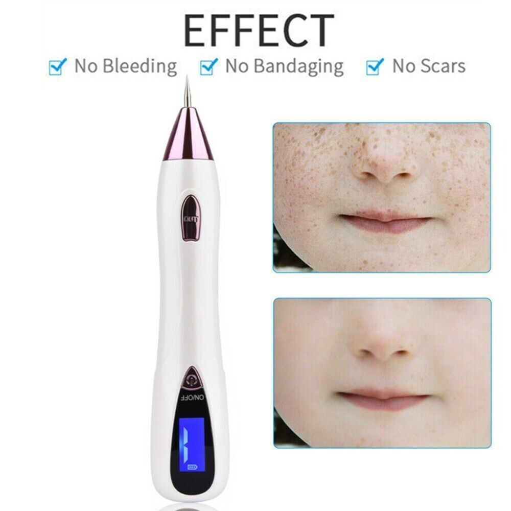 Anti-Aging Laser Rechargeable Plasma Pen Skin Dark Tag Tattoo Wart Spot Remover