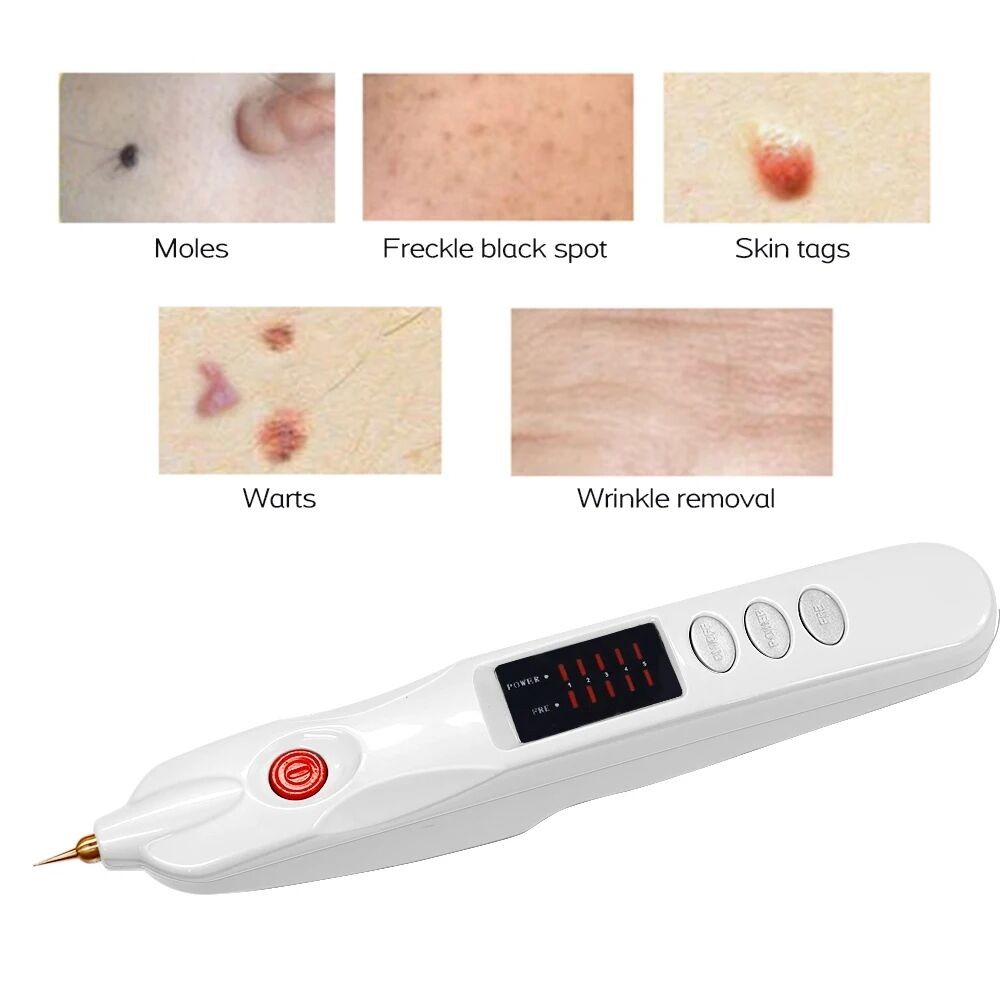 1Pcs Handheld Plasma Pen Scar Acne Freckle Mole Dark Spot Removal Device – White