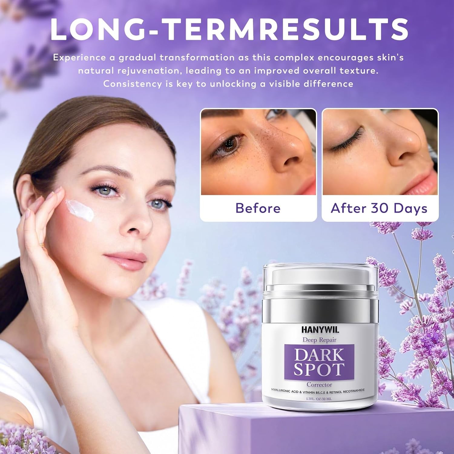 HANYWIL Dark Spot Remover for Face & Body, Remedy for Dark Spots with Natural In