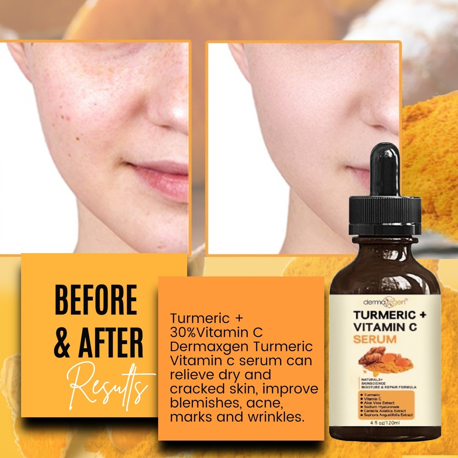 4 FL OZ – TURMERIC FACE SERUM PURE + VITAMIN C & HYALURONIC ACID, ORGANIC